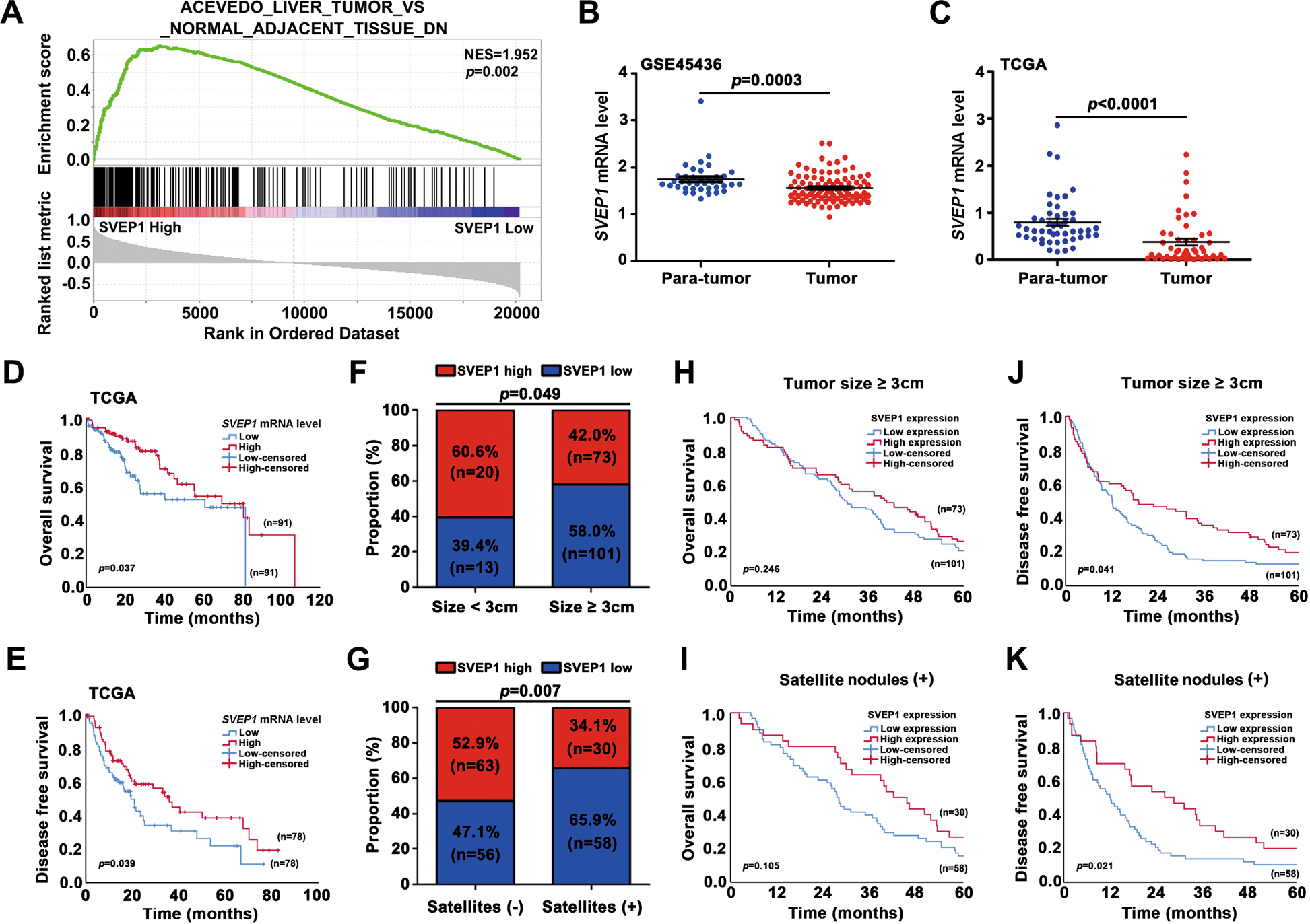 Fig. 2: The relationship between SVEP1 expression and clinicopathological features of HCC.
