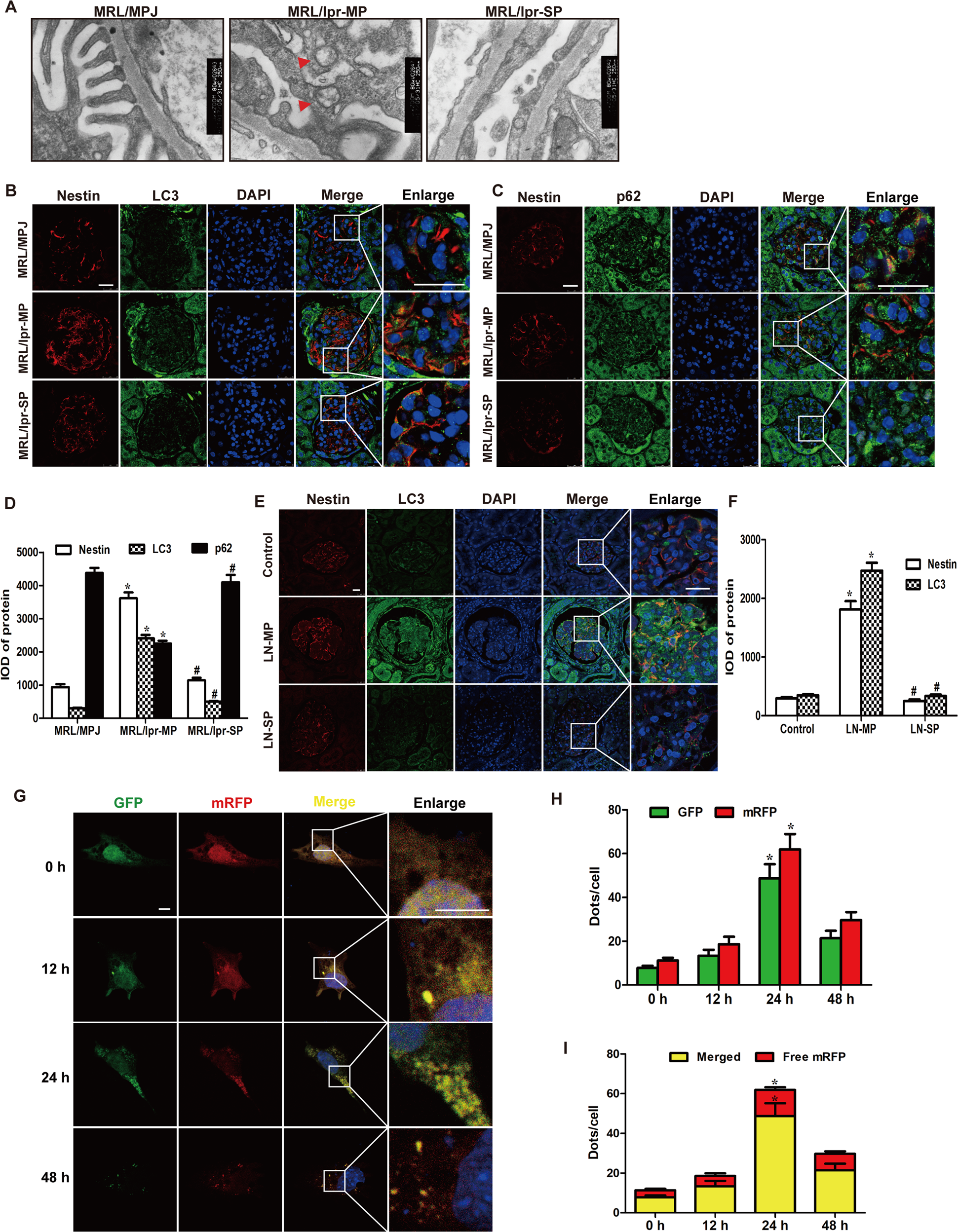 Fig. 3: Autophagy was increased in podocytes of lupus nephritis with mild proteinuria.