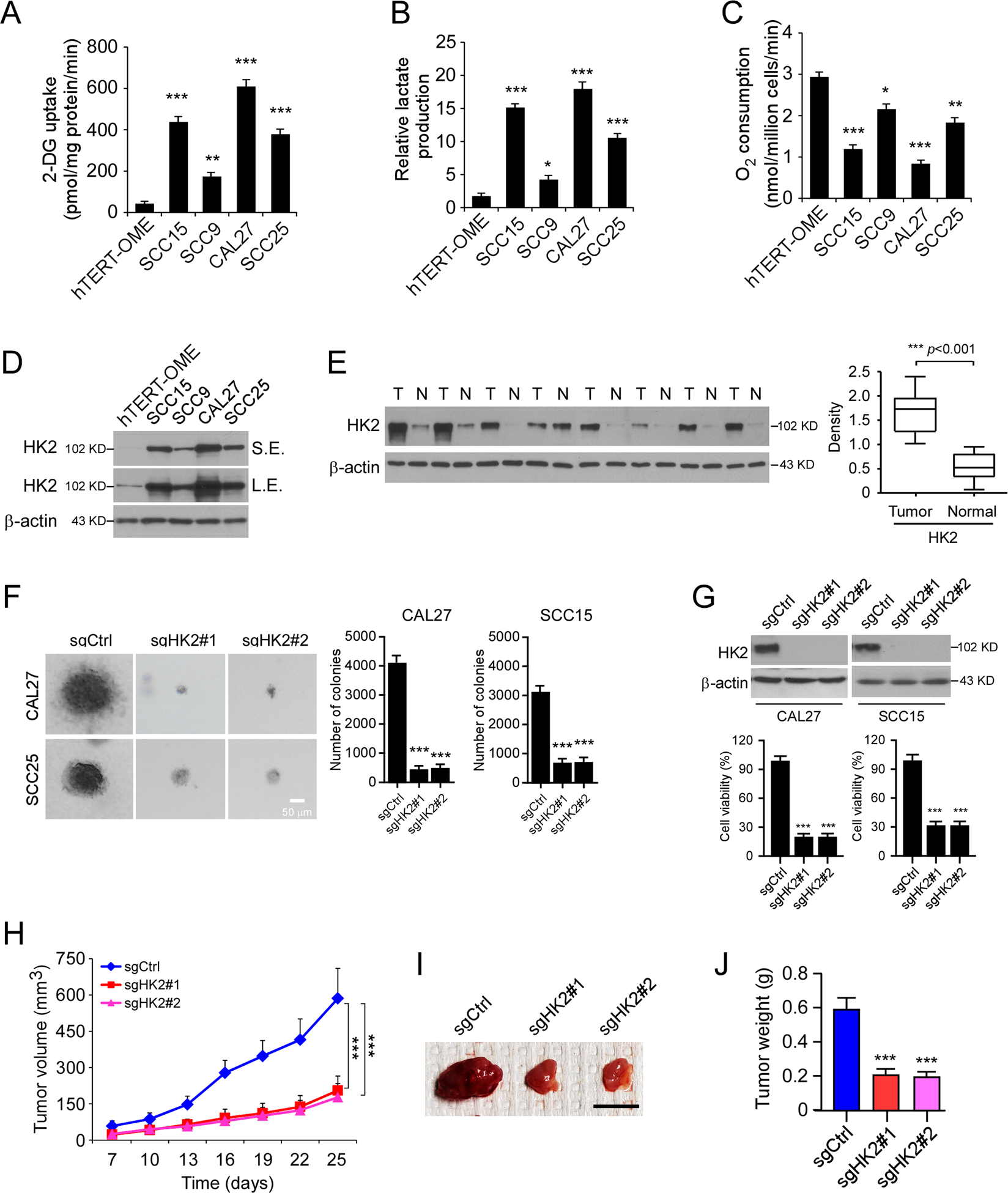 Fig. 1: HK2 is highly expressed in oral squamous cell carcinoma (OSCC) cells.