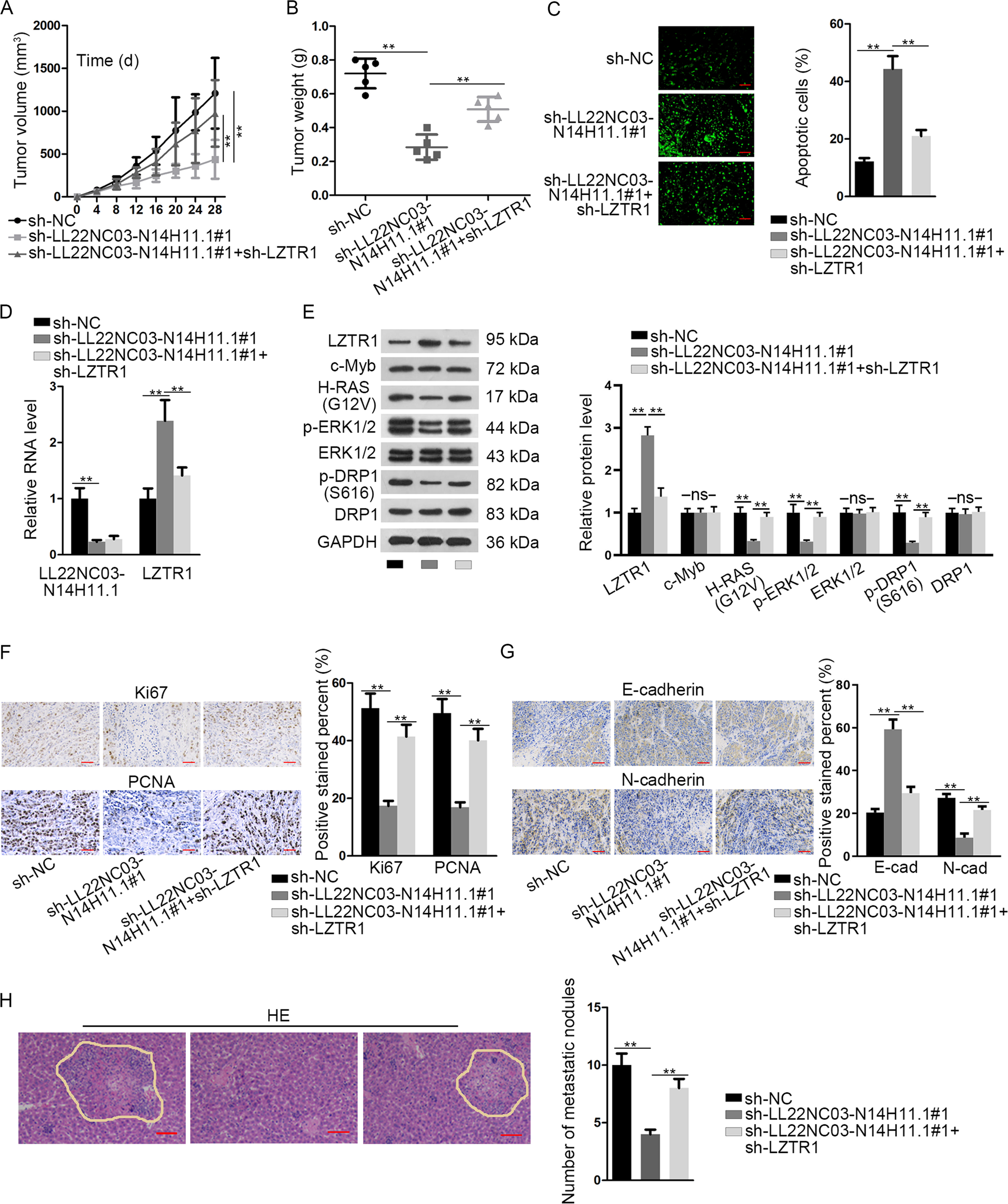 Fig. 7: LL22NC03-N14H11.1 drove tumorigenesis and metastasis in HCC through LZTR1 in vivo.