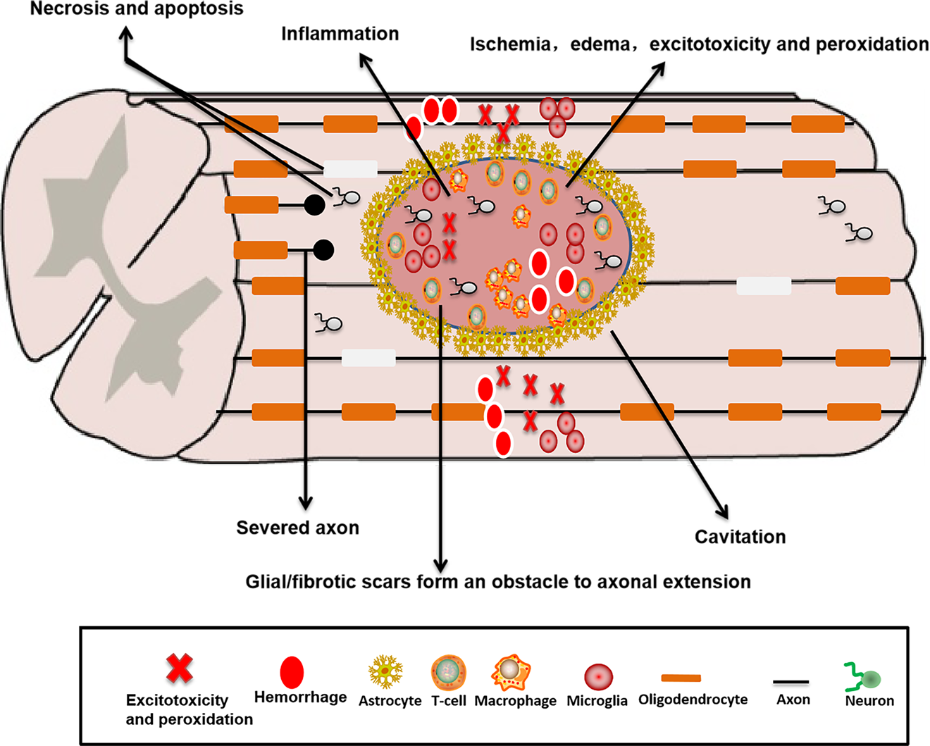 Fig. 2: Pathophysiological mechanism of SCI.