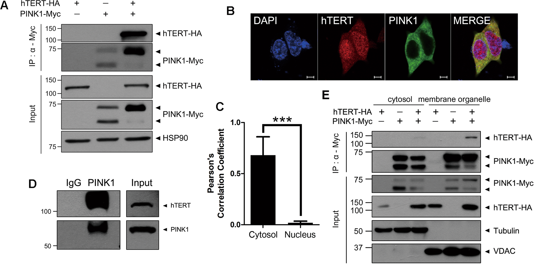 Human Telomerase Reverse Transcriptase Positively Regulates Mitophagy By Inhibiting The Processing And Cytoplasmic Release Of Mitochondrial Pink1 Cell Death Disease Human Telomerase Reverse Transcriptase Positively Regulates Mitophagy By Inhibiting The Processing And Cytoplasmic Release Of Mitochondrial Pink1 Cell Death Disease