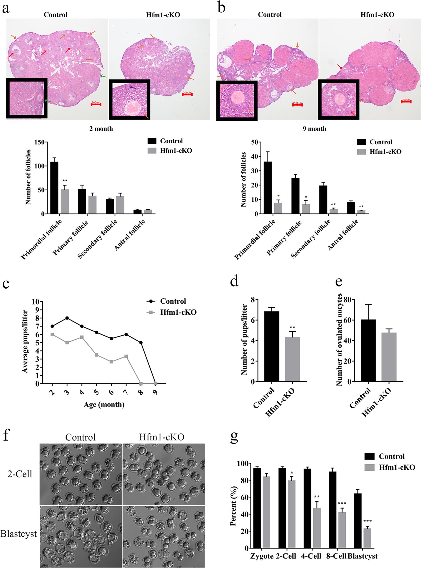 Fig. 2: Compromised fertility in Hfm1-cKO mice.