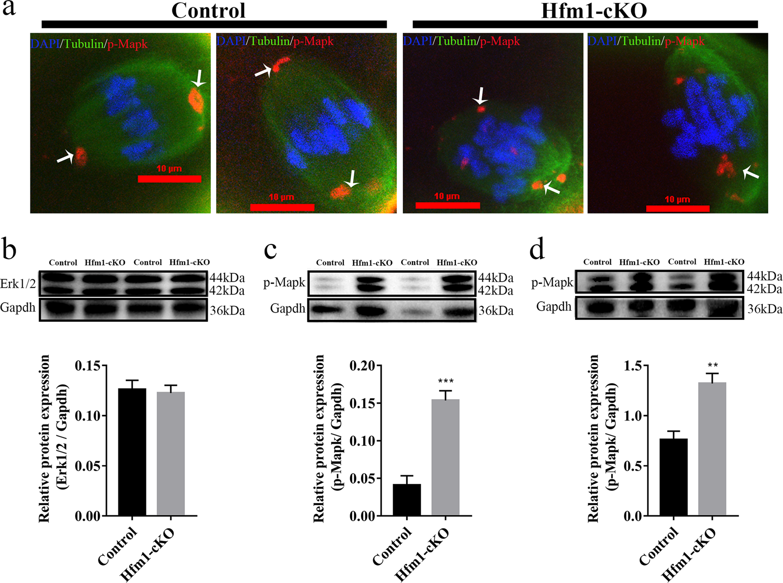 Fig. 5: Disrupted MAPK pathway in Hfm1 knockout oocytes.