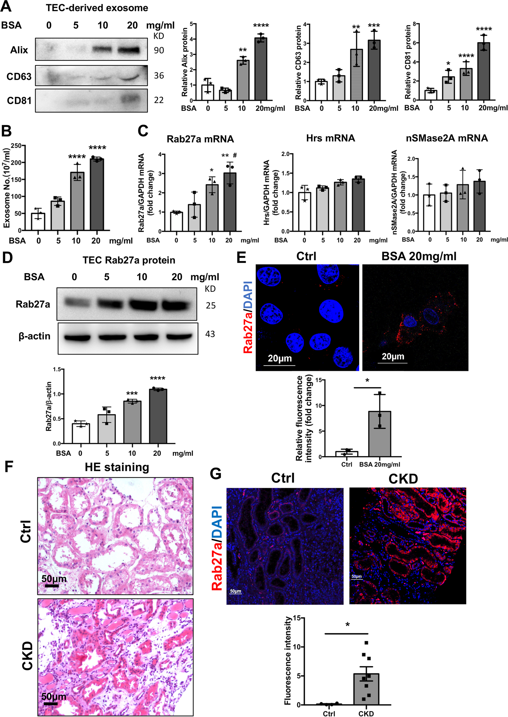 Fig. 3: Albumin overload promoted exosomes secretion and Rab27a expression in a dose-dependent manner.