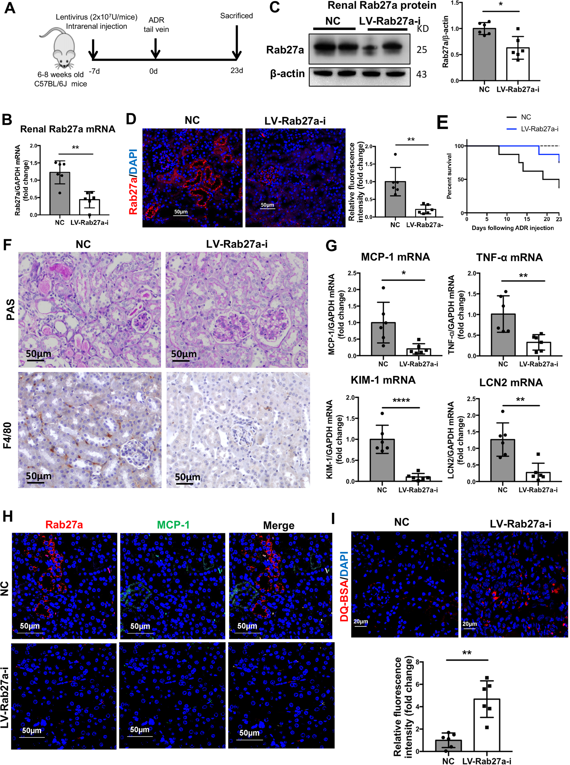 Fig. 7: Inhibition of Rab27a dependent exosome secretion ameliorates proteinuric kidney injury.