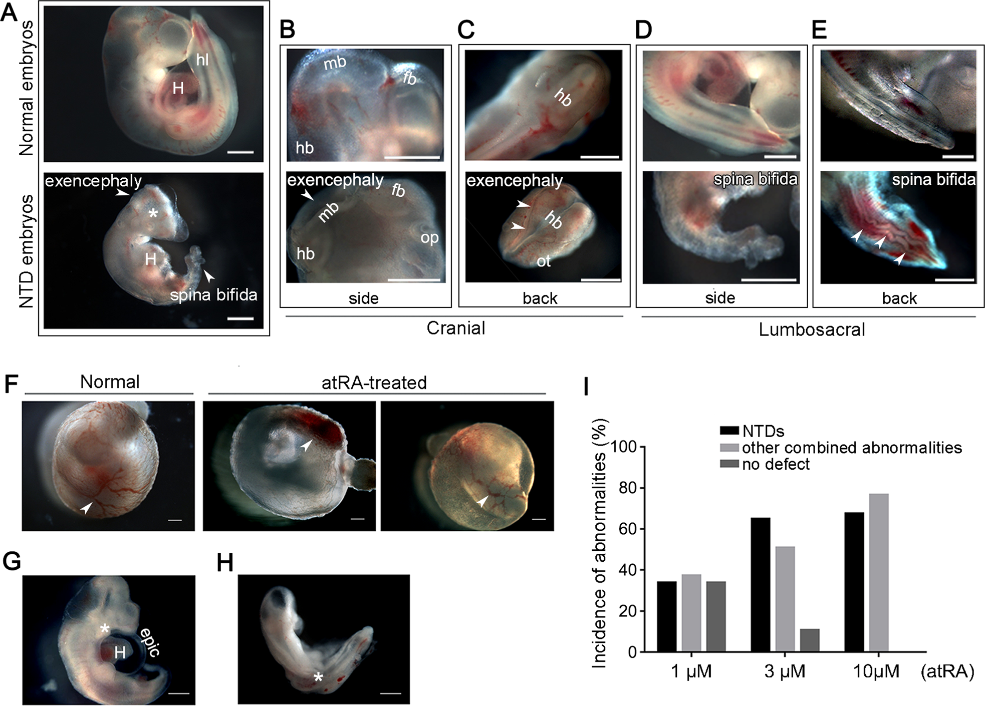 Fig. 1: atRA induces NTDs in rat embryos ex vivo.