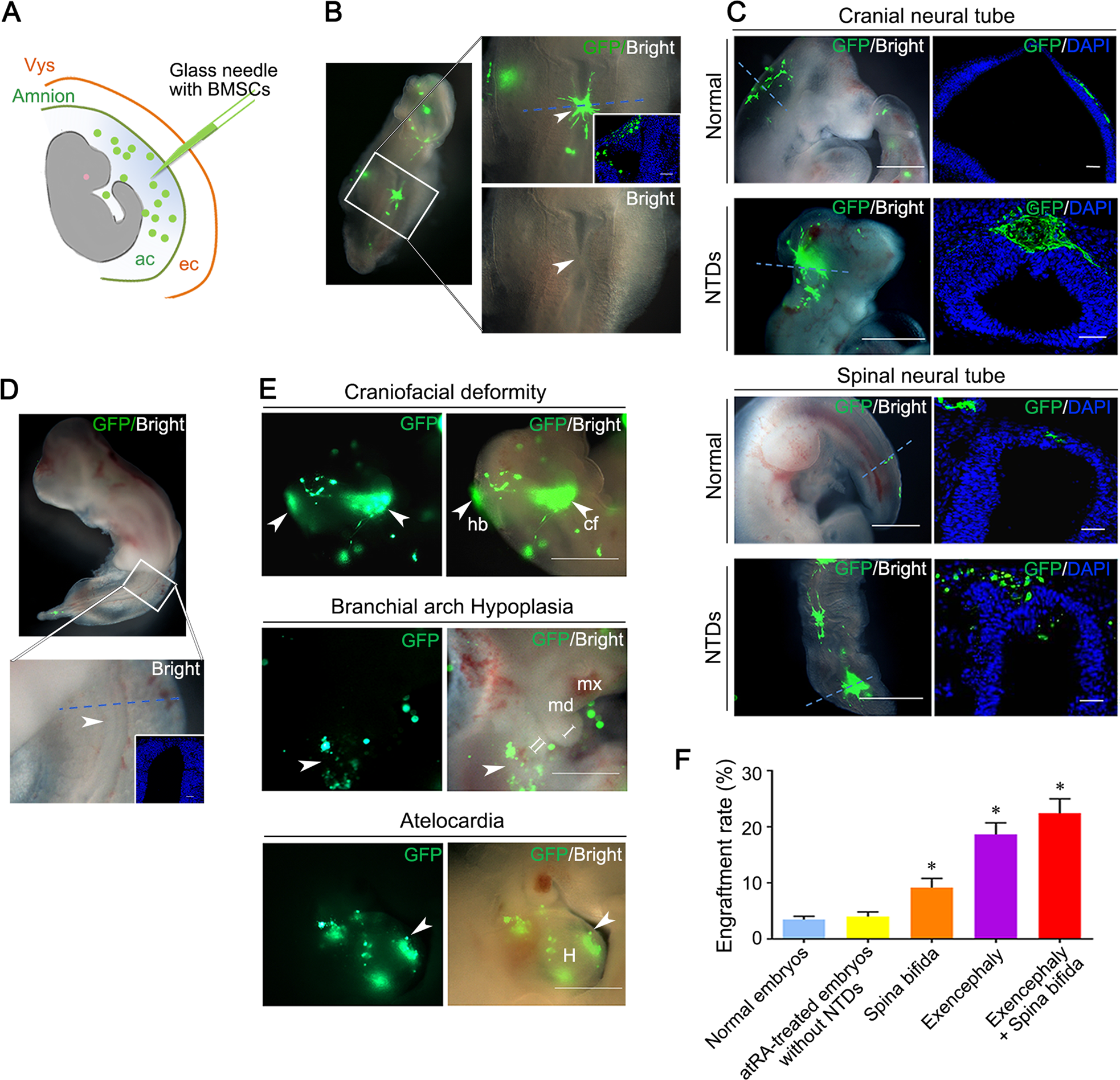 Fig. 2: GFP-labeled BMSCs specifically engraft into NTD-lesions.