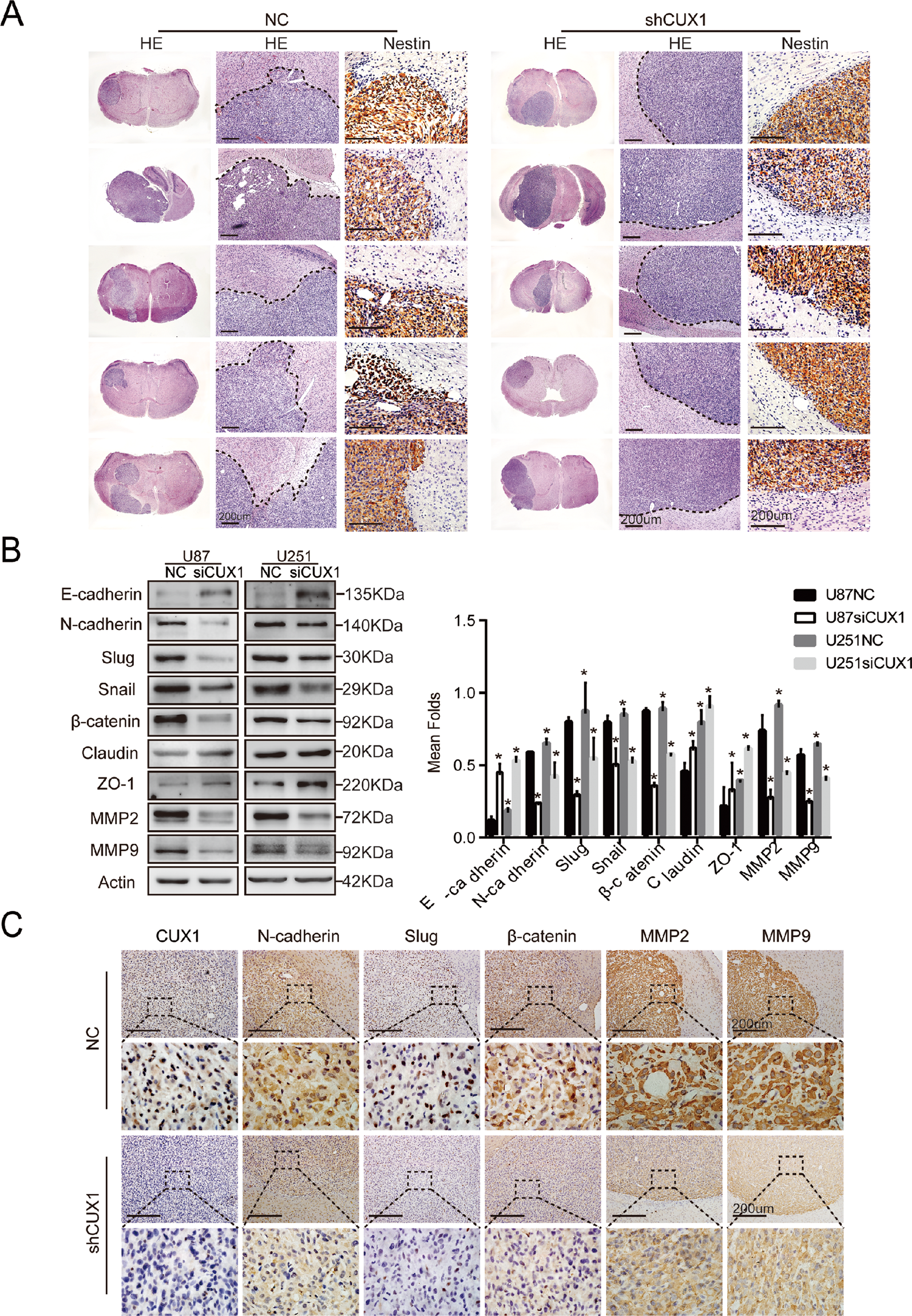 Fig. 3: CUX1 knockdown inhibited cell migration and invasion by regulating EMT progression and MMPs expression in vitro and in vivo.