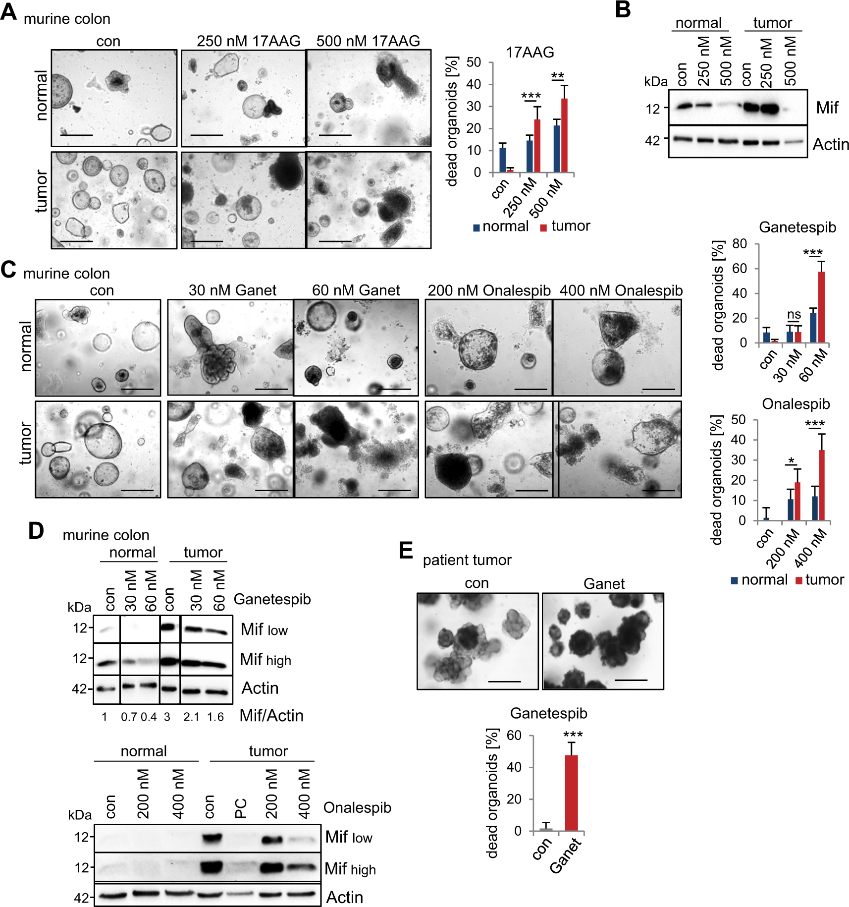 Fig. 7: MIF is an actionable and selective therapeutic target via Hsp90 inhibition in CRC-derived organoids.
