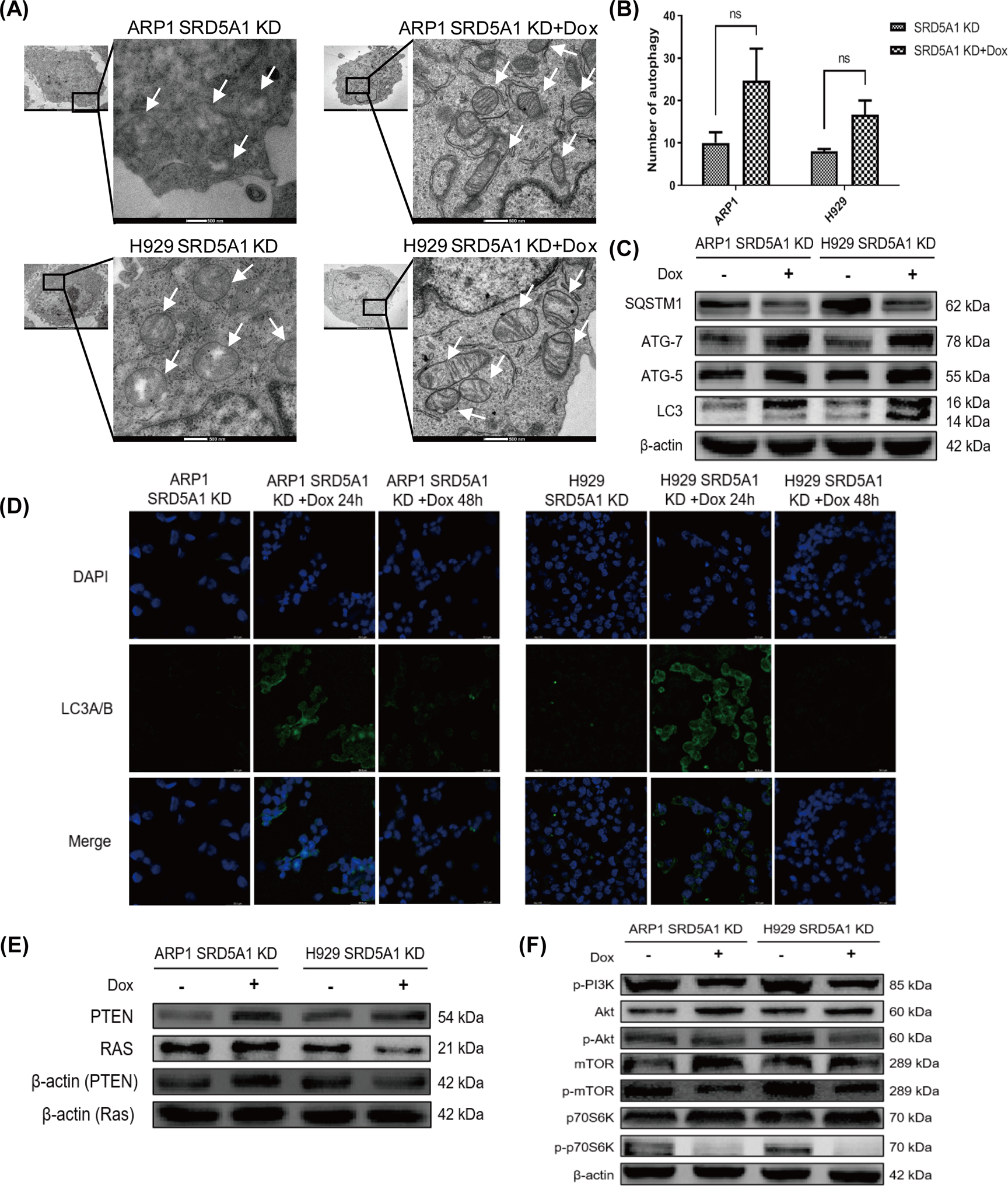 Fig. 5: SRD5A1 knockdown induces autophagy via PI3K/Akt/mTOR pathway.