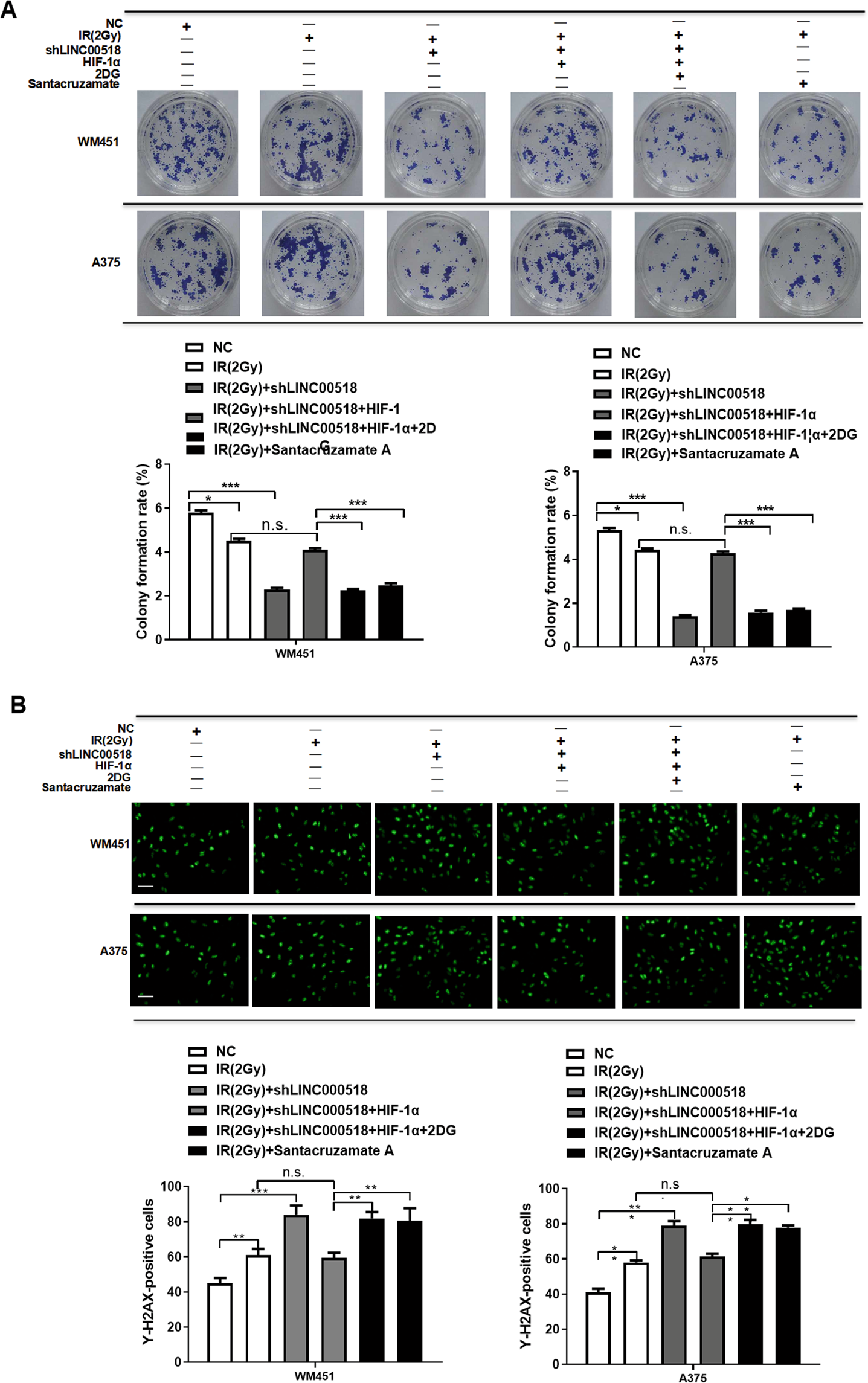 Fig. 7: Involvement of the LINC00518/miR-33a-3p/HIF-1α negative feedback loop in glycolysis-mediated radiotherapy resistance of CMM cells.
