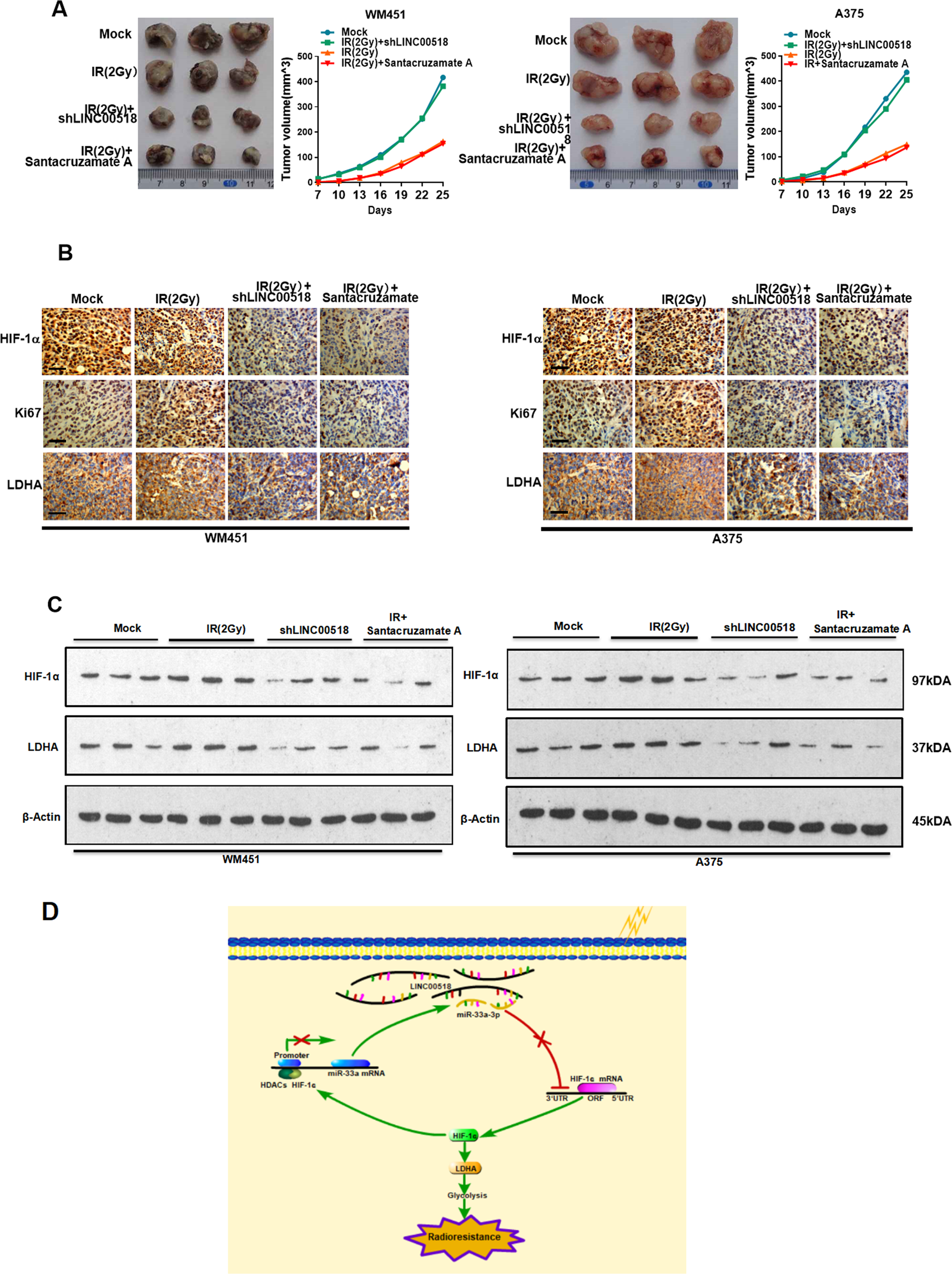 Fig. 8: Effect of the LINC00518/miR-33a-3p/HIF-1α negative feedback loop on radiosensitivity in CMM cells in vivo.