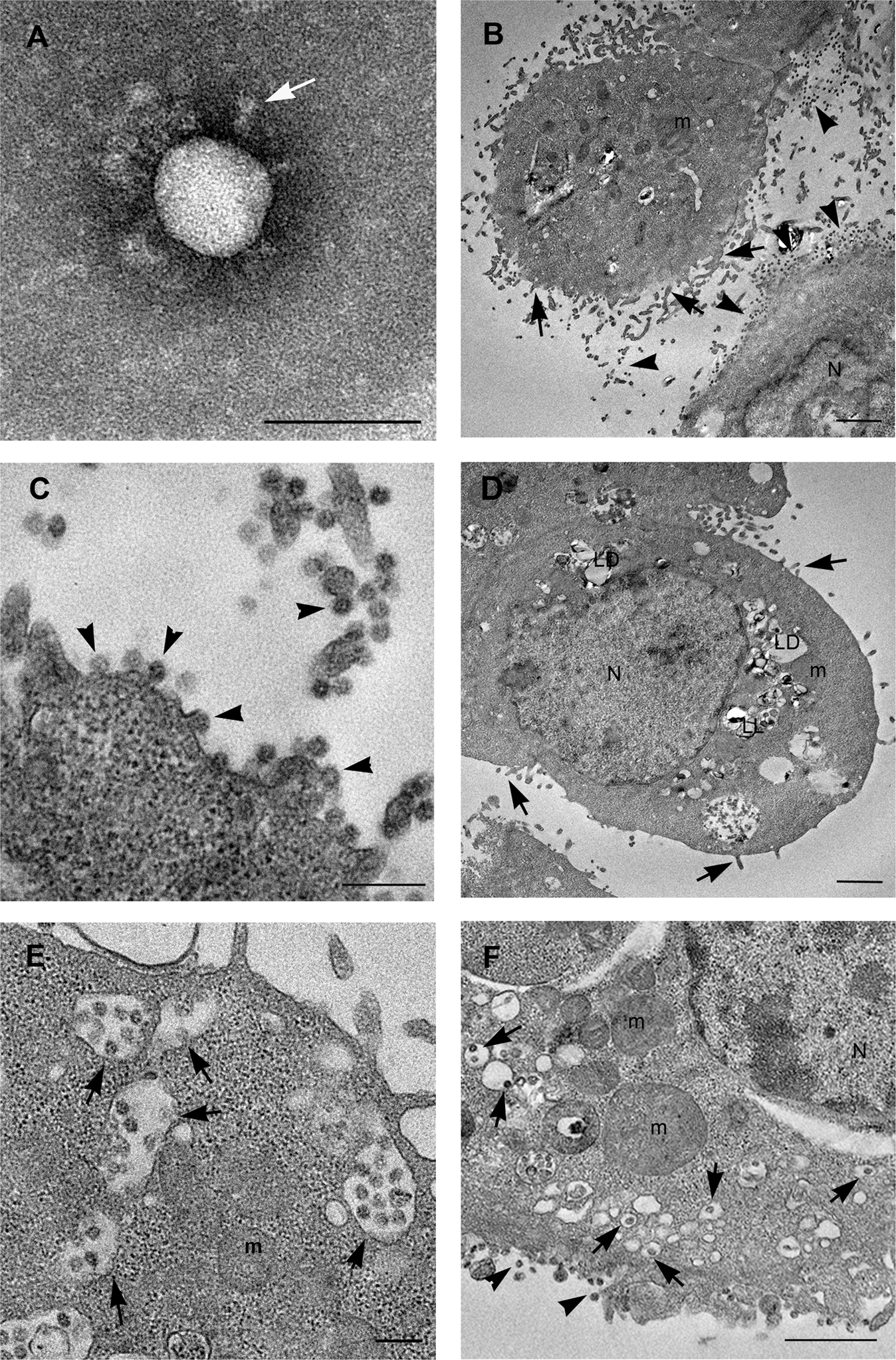 Fig. 1: Electron microscopy images of SARS-CoV-2 virus and infected Vero cells.