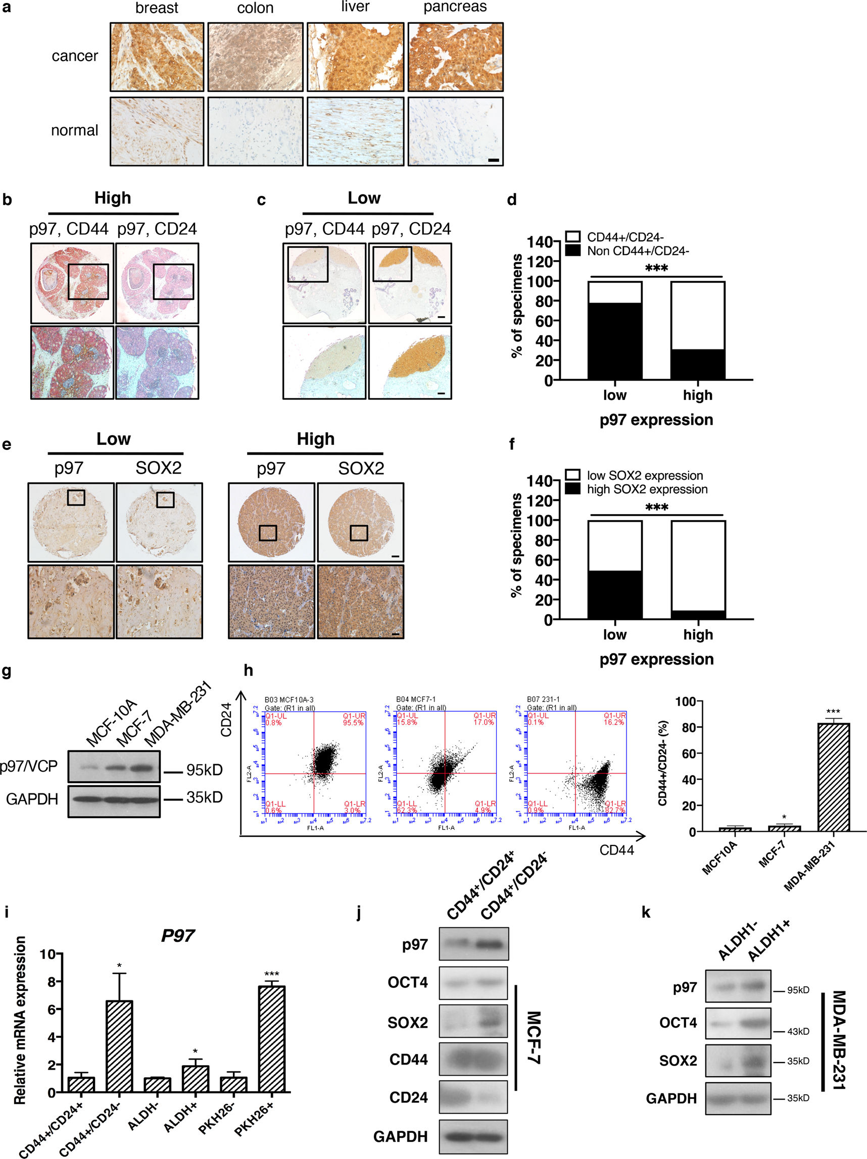 Fig. 1: p97 expression is higher in the breast CSC population.