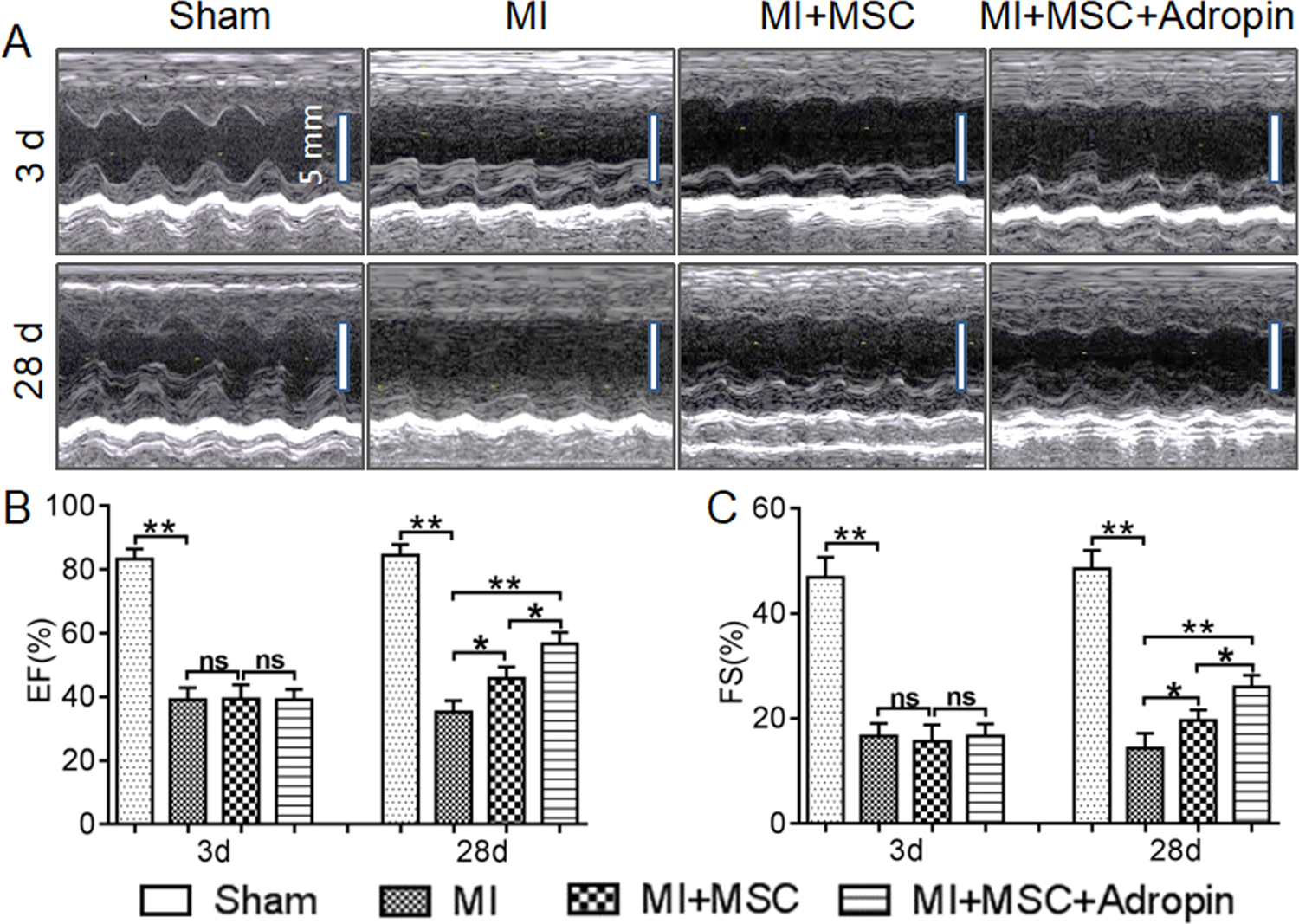 Fig. 2: Improved cardiac function by adropin-based dual treatment through modifying both transplanted MSCs and host MI microenvironment in rats.