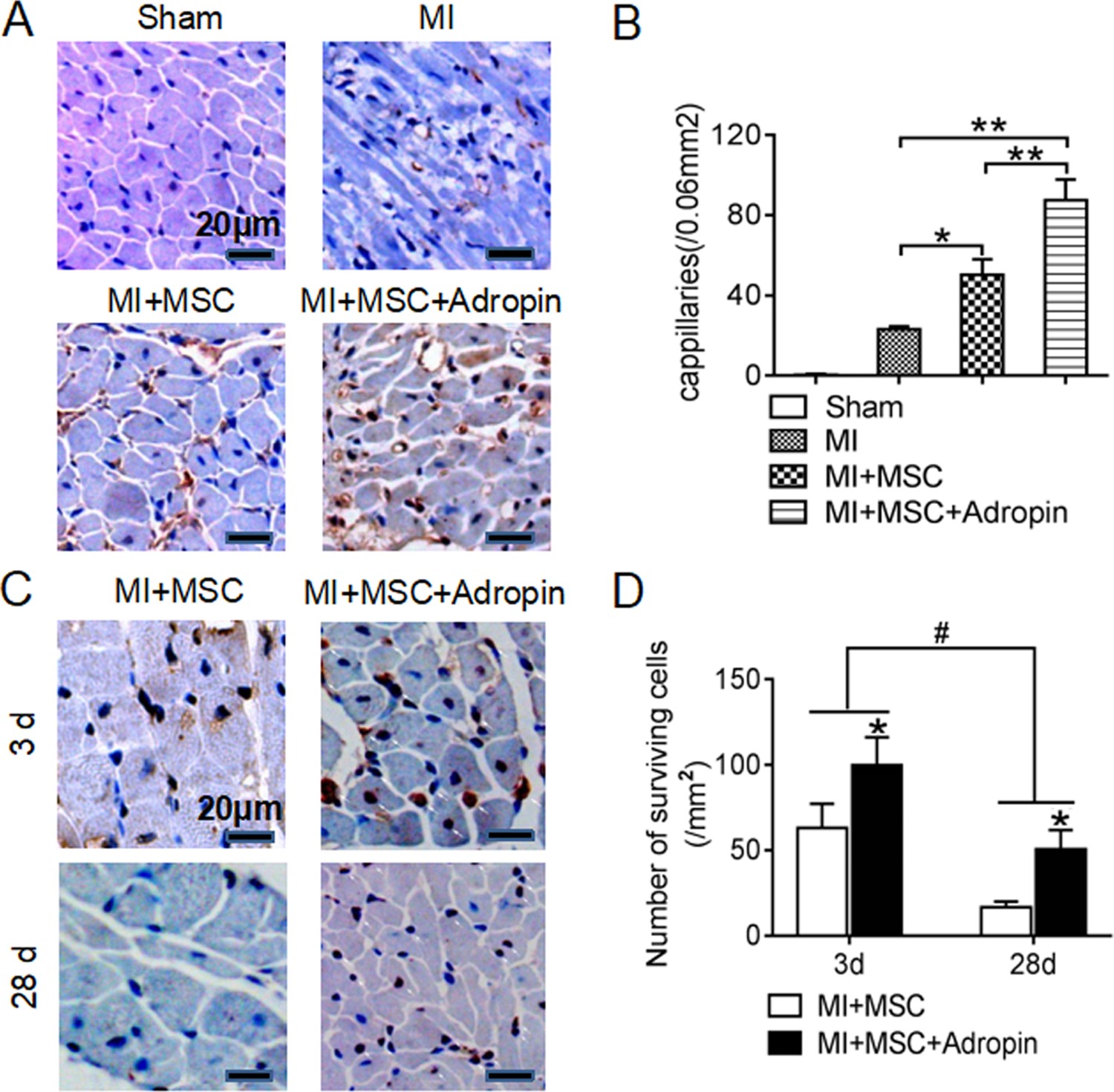 Fig. 5: Increased neovascularization and number of surviving transplanted MSCs by adropin-based dual treatment in rat myocardial infarction.