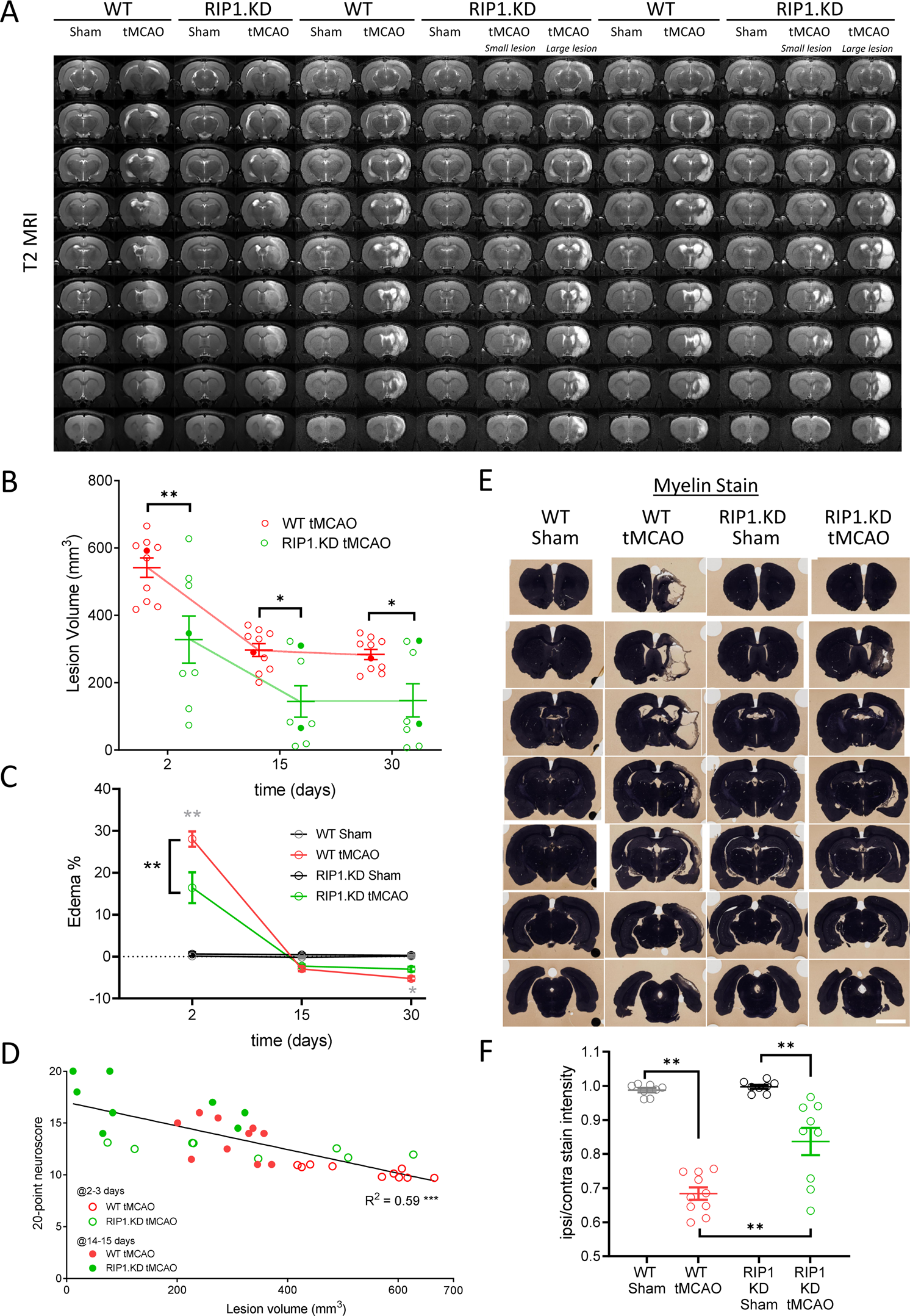 Fig. 3: Genetic inactivation of RIP1 kinase activity preserves tissue integrity following ischemic brain injury.