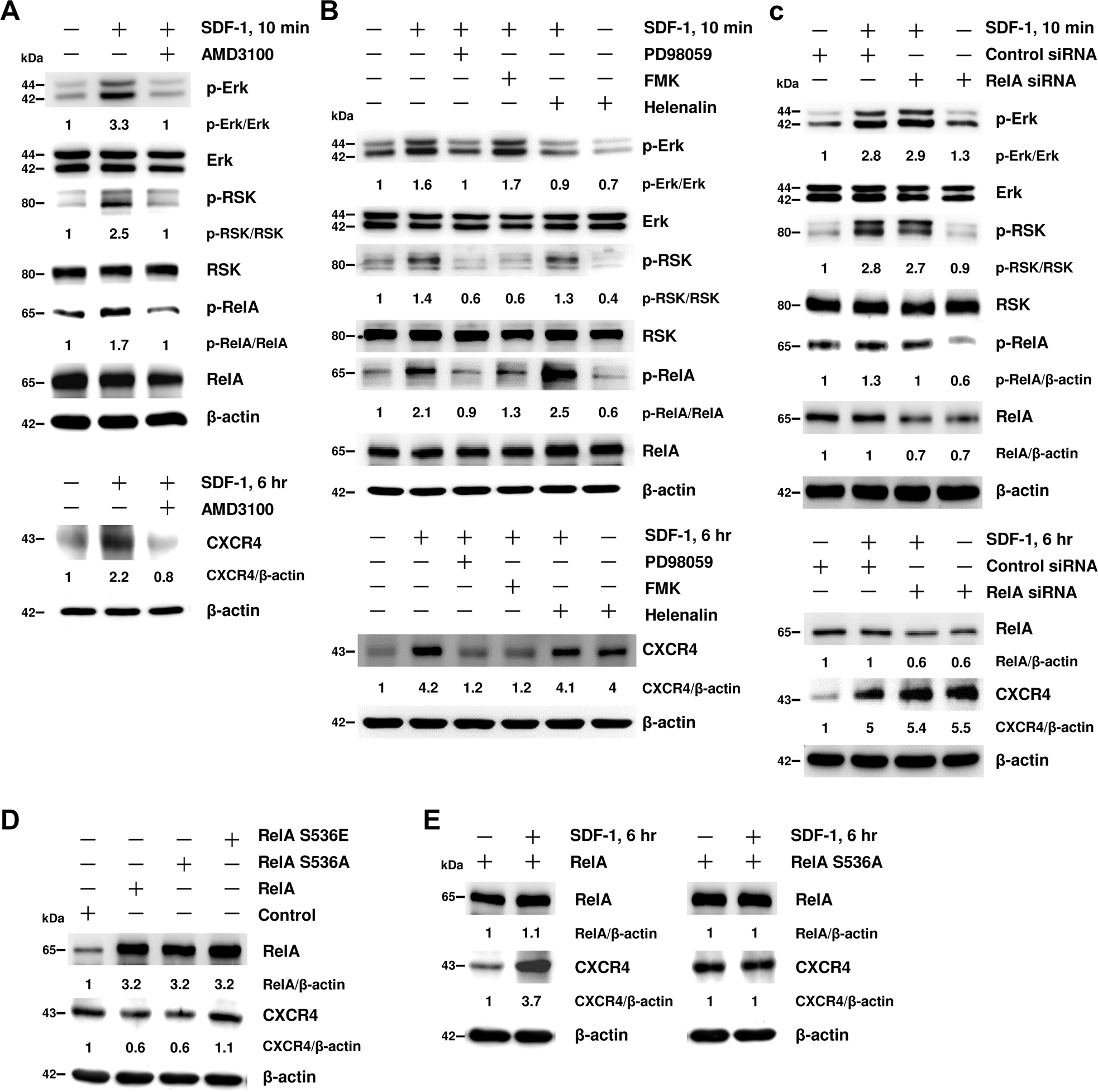 Fig. 3: RelA conducts as a transcriptional repressor of CXCR4 gene in EPCs.