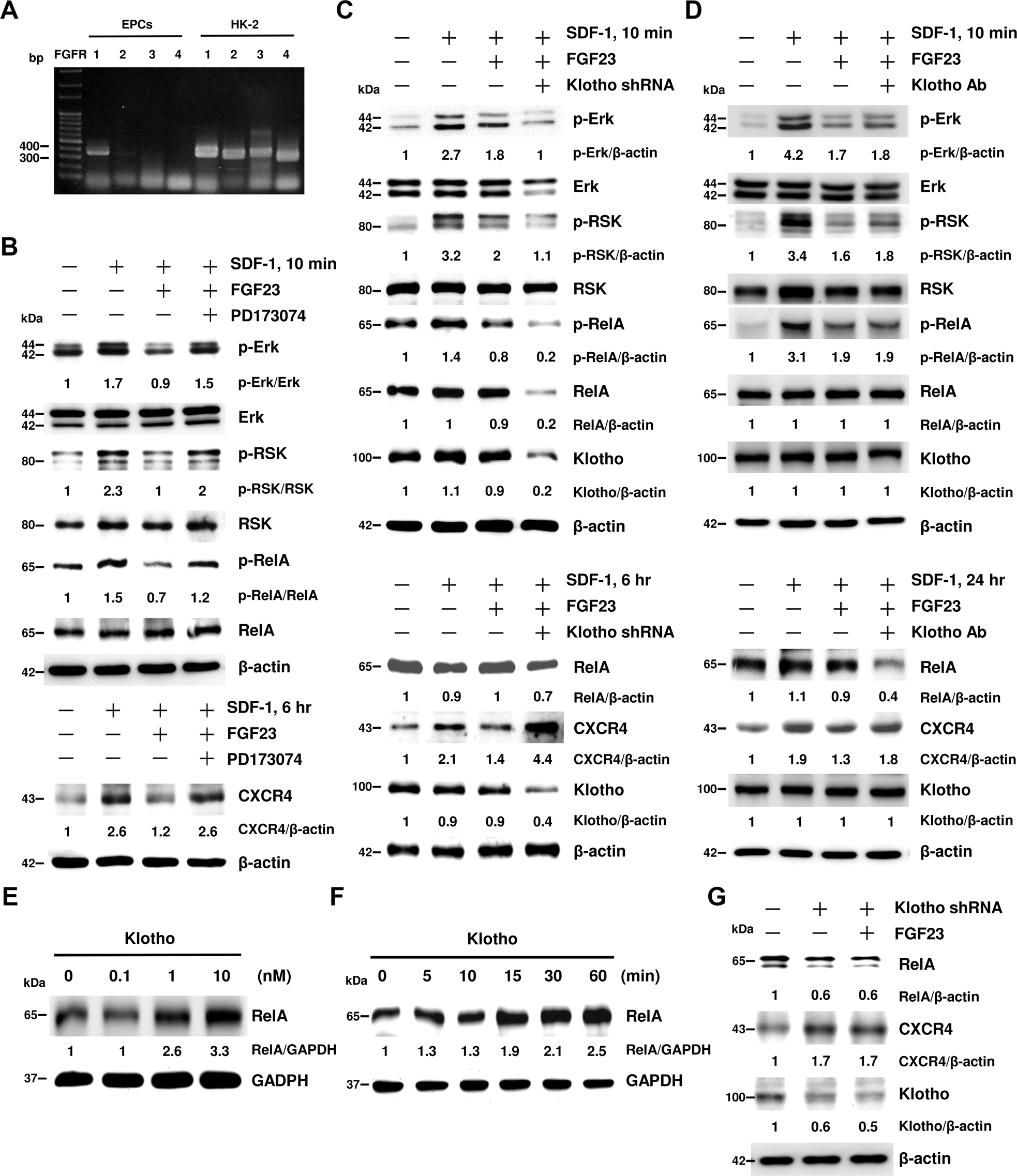 Fig. 5: FGF23 attenuates SDF-1-induced CXCR4 expression via interaction of FGF receptor-1 (FGFR1), but not Klotho.