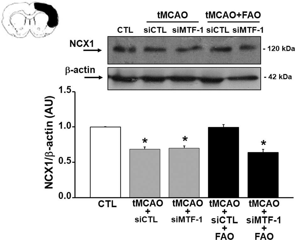 Fig. 5: Knocking down MTF-1 by siRNA strategy reverted RLIP-induced upregulation of NCX1.