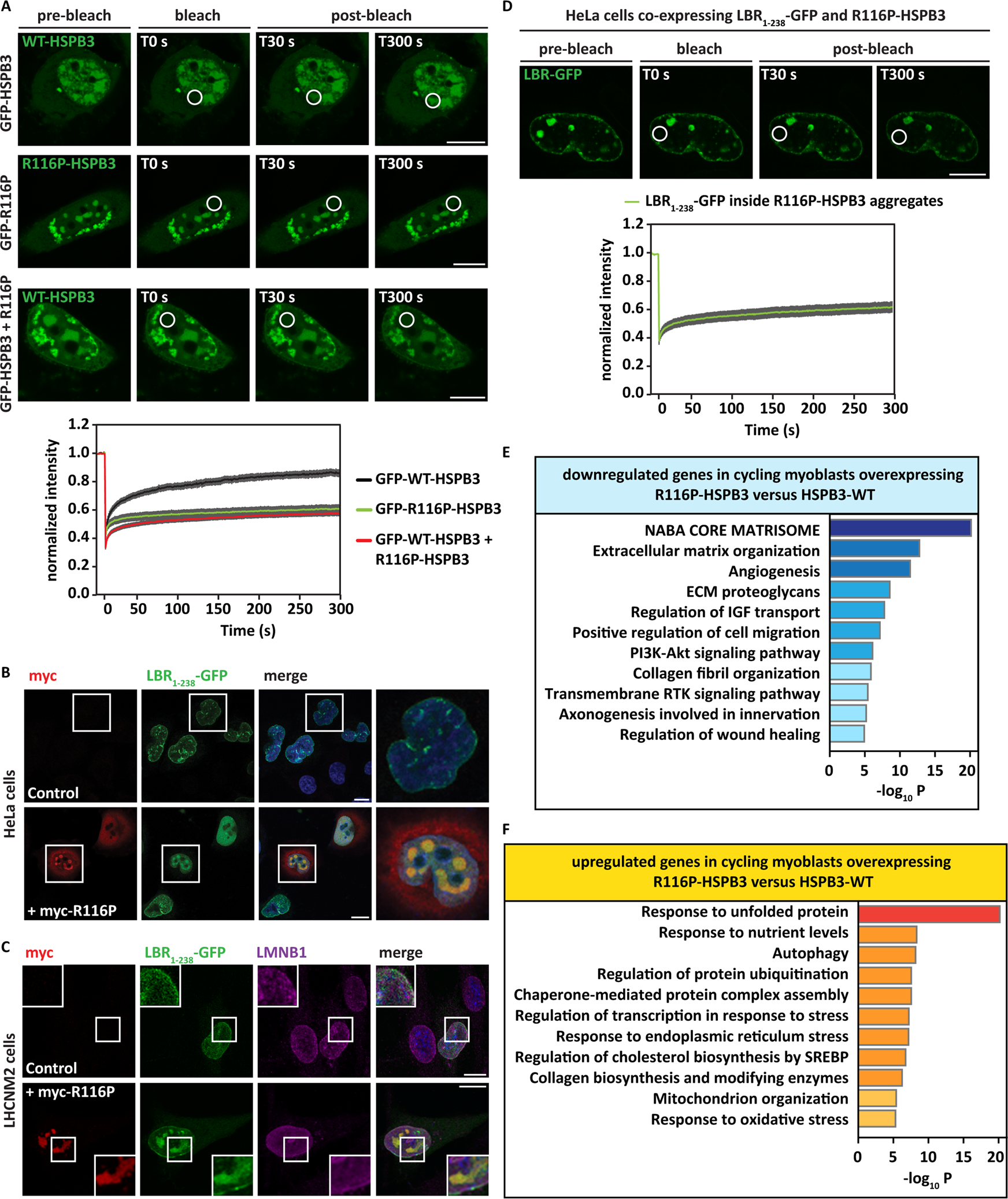 Fig. 6: R116P-HSPB3 forms nuclear aggregates that sequester LBR1-238-GFP and induce a stress response.