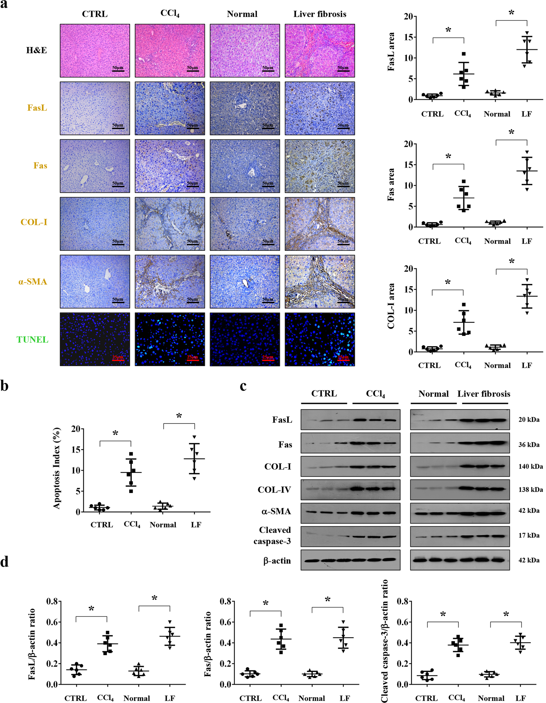 Fas/FasL mediates NF-κBp65/PUMA-modulated hepatocytes apoptosis via  autophagy to drive liver fibrosis | Cell Death & Disease