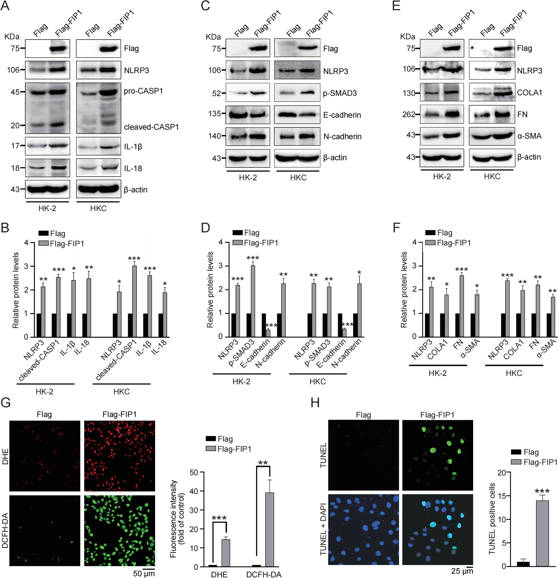 Fig. 5: FIP1 promotes inflammation, fibrogenesis, ROS production, and apoptosis in renal tubular epithelial cells.