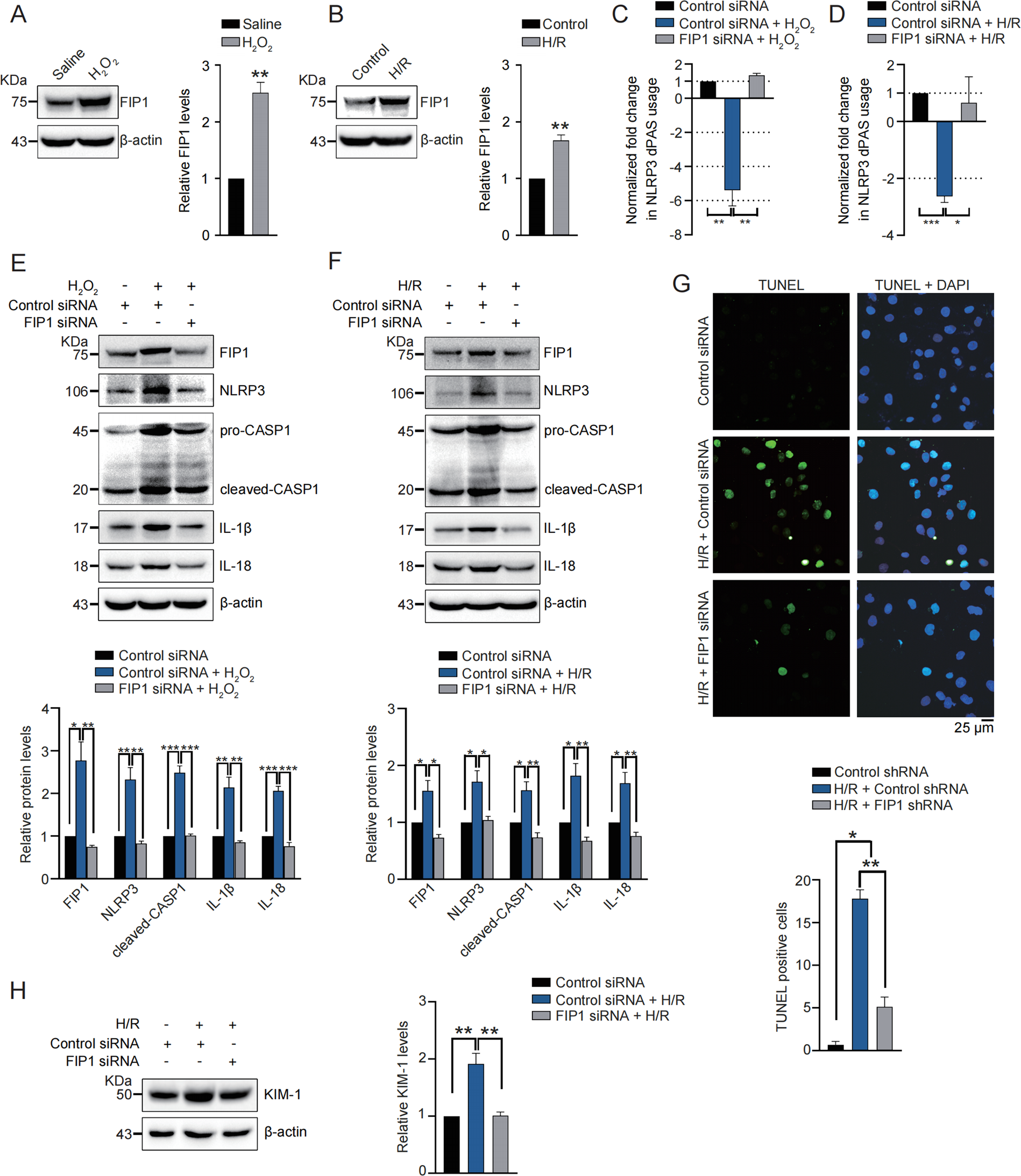 Fig. 6: FIP1 is upregulated by oxidative stress and required for oxidative stress-induced NLRP3 upregulation, inflammation, apoptosis, and cell damage.