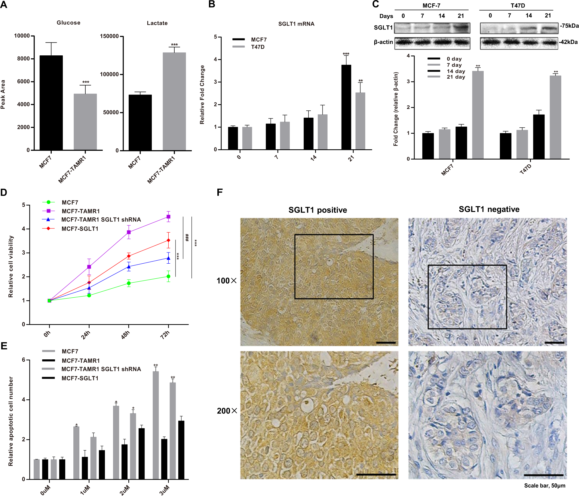 Fig. 1: SGLT1 is overexpressed in tamoxifen-resistant ER-positive breast cancer cell lines and tissues.