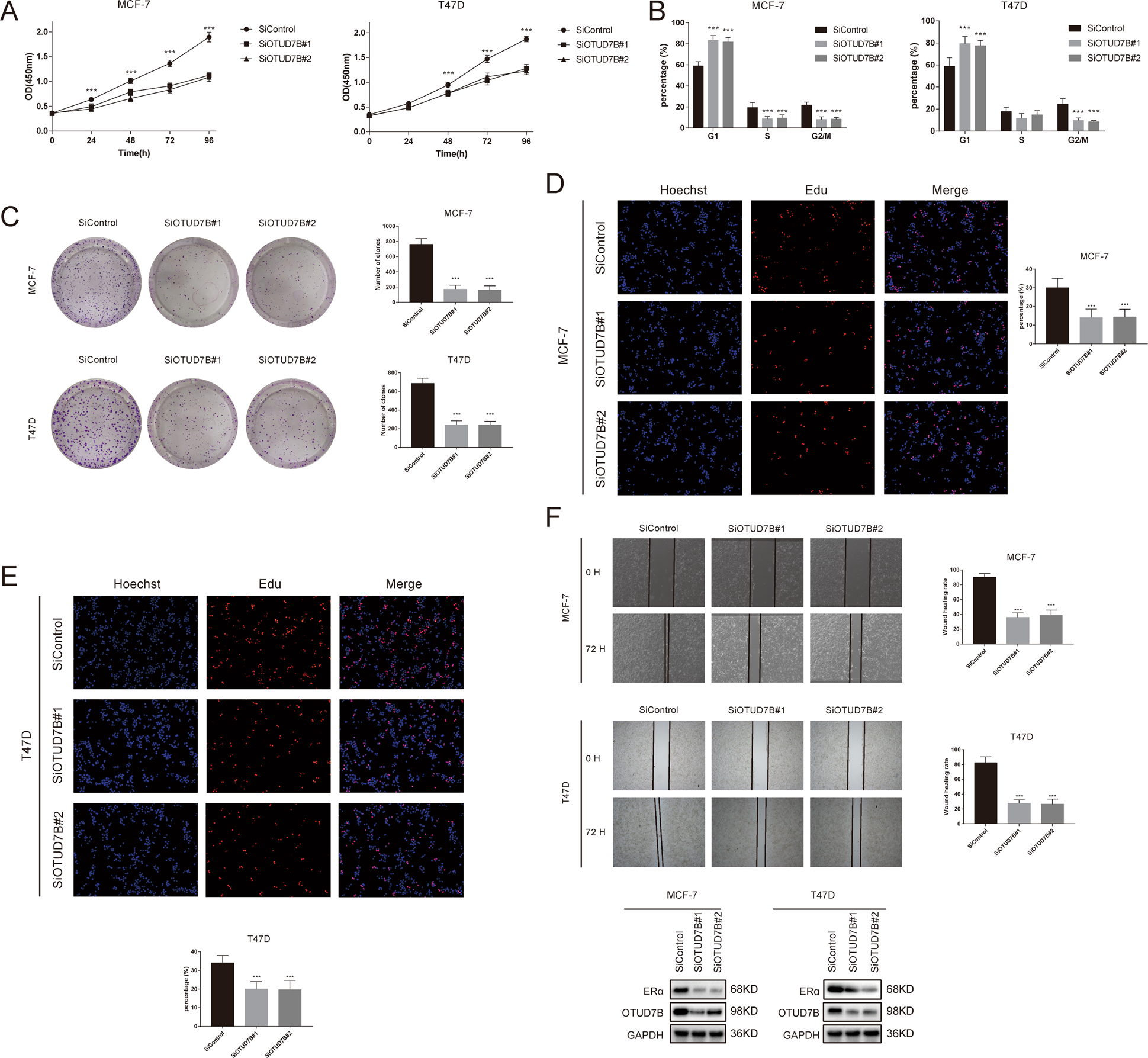 Fig. 7: OTUD7B depletion inhibits ERα-positive breast cancer cell proliferation and migration.