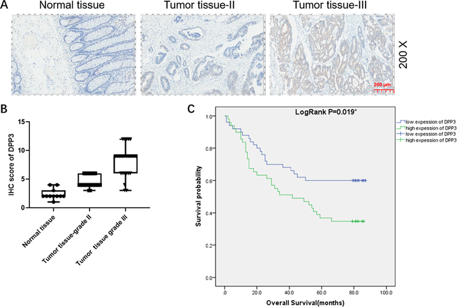 Fig. 1: DPP3 was upregulated in CRC and knockdown of DPP3 cells models was constructed.