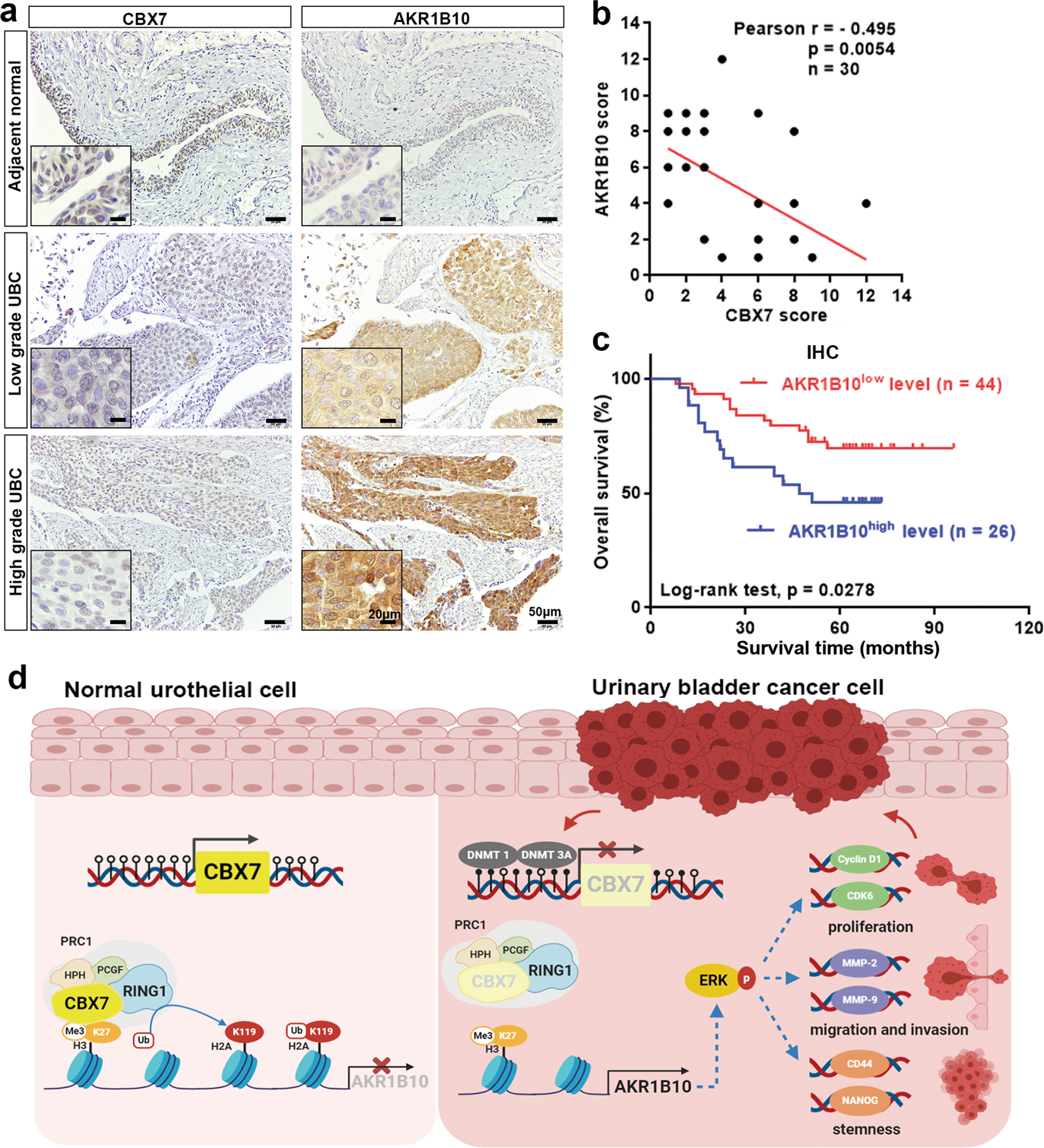 Fig. 8: The dysregulation of CBX7–AKR1B10 axis is associated with poor clinical outcome.