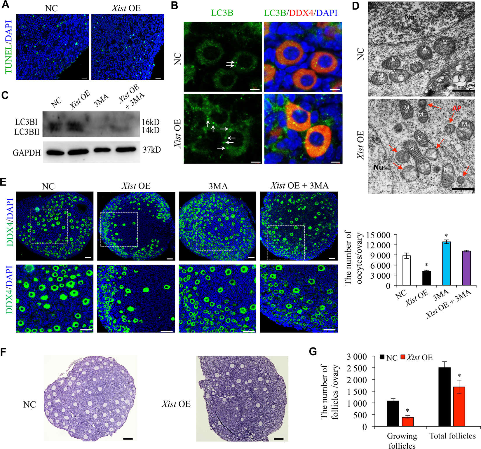 Fig. 2: Xist promotes oocyte autophagy during PF formation.