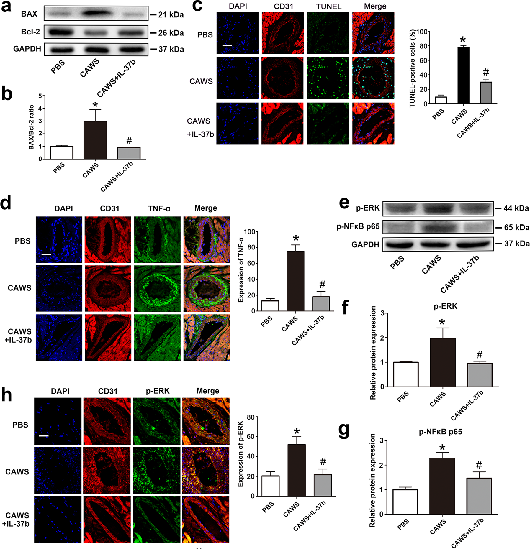 Fig. 6: Endothelial cell apoptosis and inflammation were alleviated in a KD mouse model after IL-37b treatment.