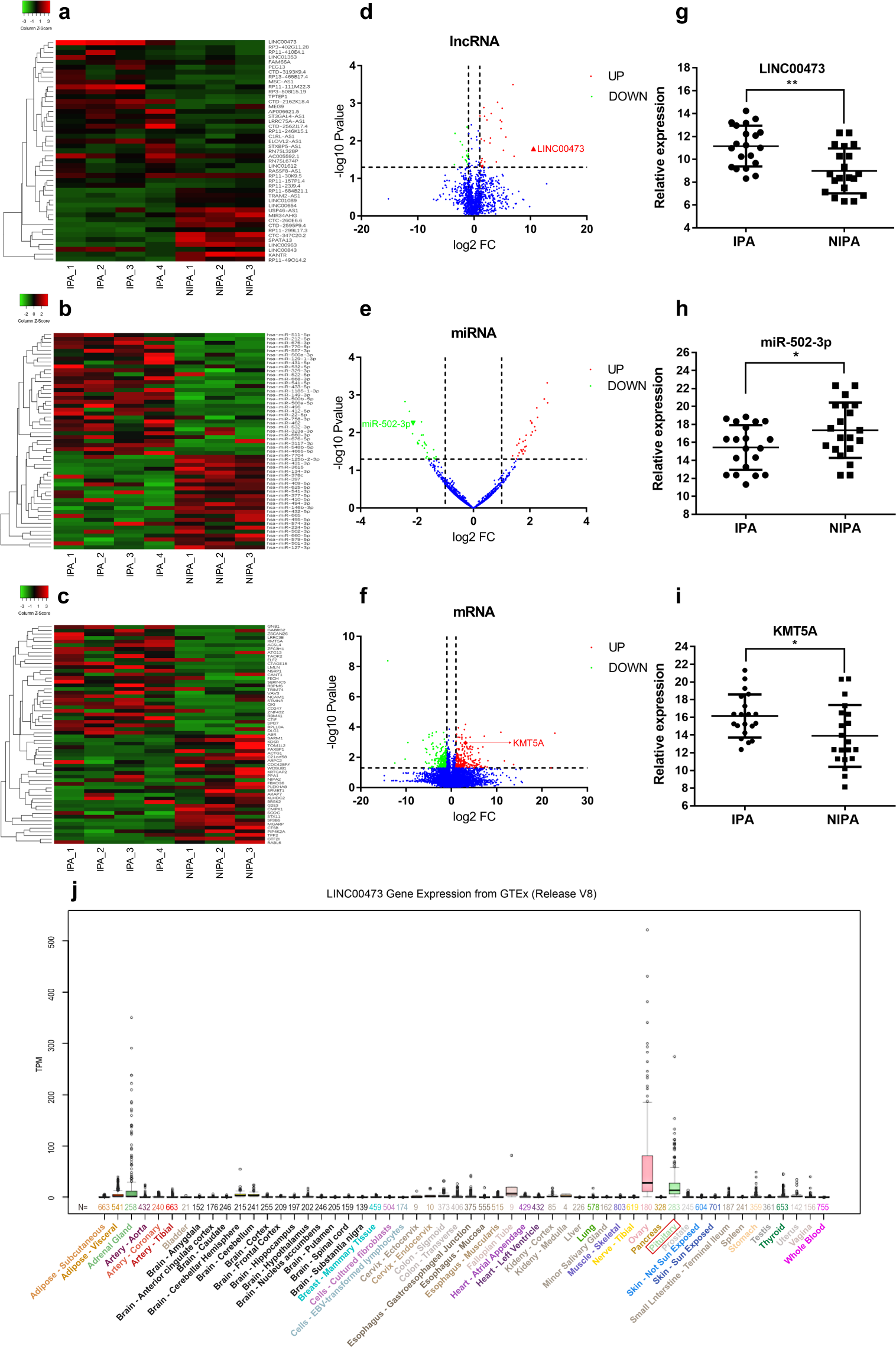 Fig. 2: Characterization of LINC00473 and its corresponding ceRNA network (lncRNA-miRNA-mRNA) in IPA.