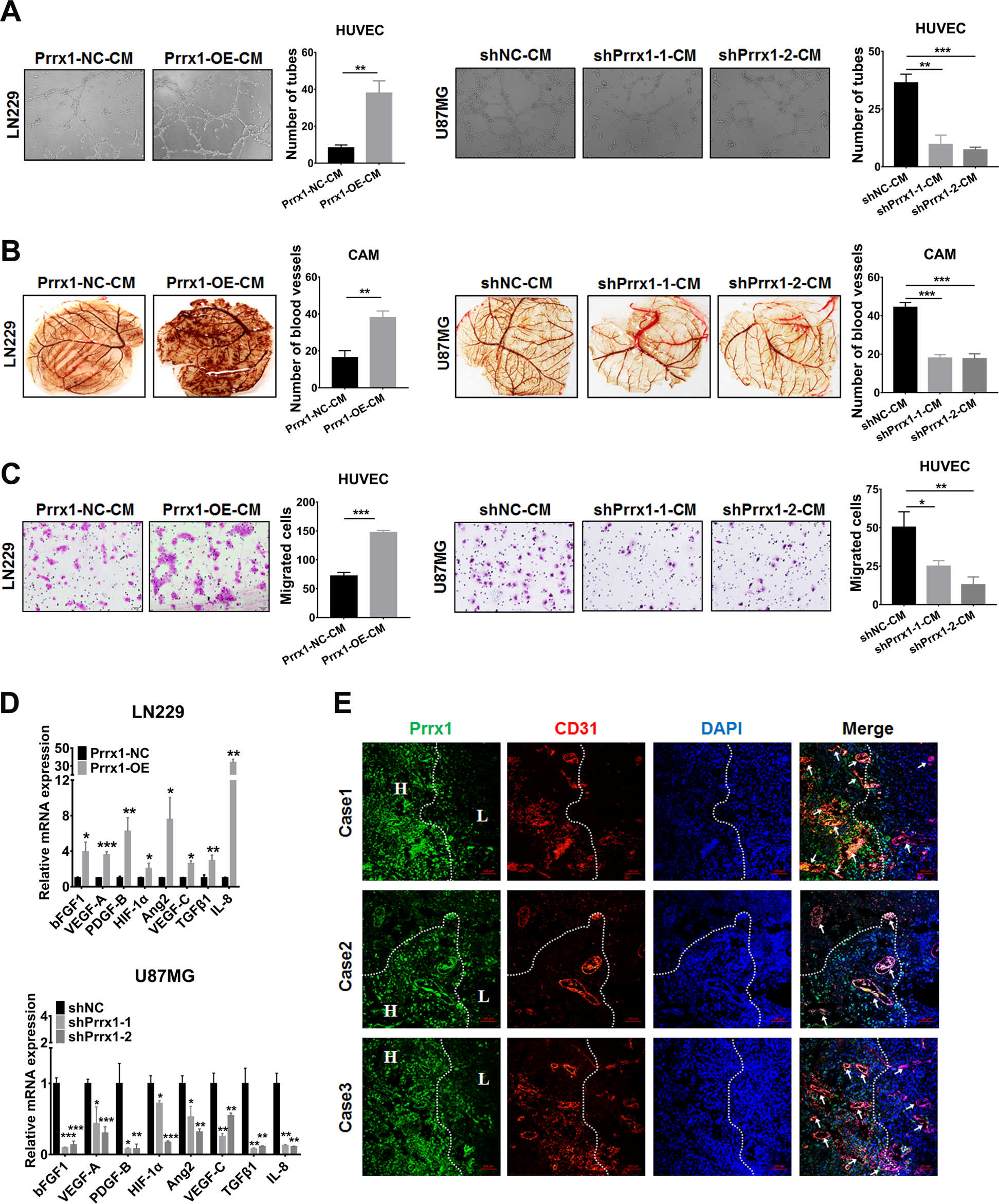 Fig. 3: Prrx1 promotes glioma angiogenesis through upregulating proangiogenic factors in NSTCs.