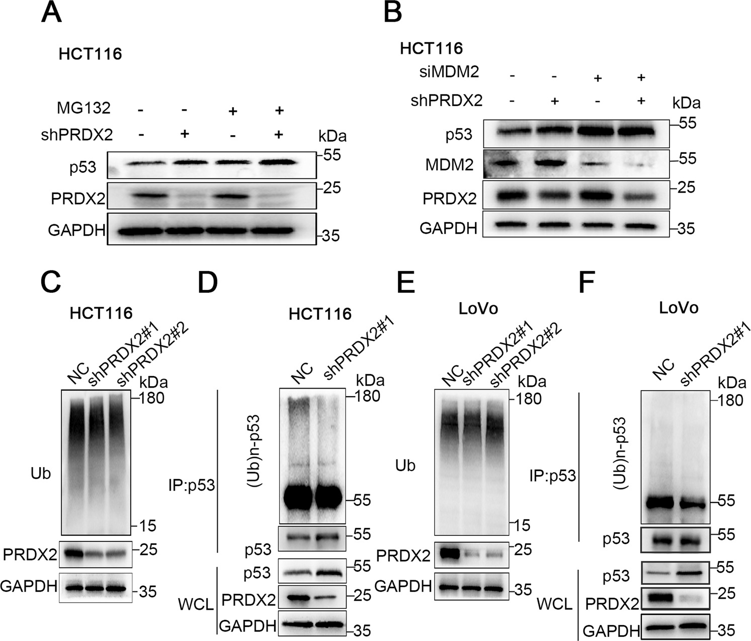 Fig. 5: PRDX2 increases MDM2-induced p53 ubiquitination.