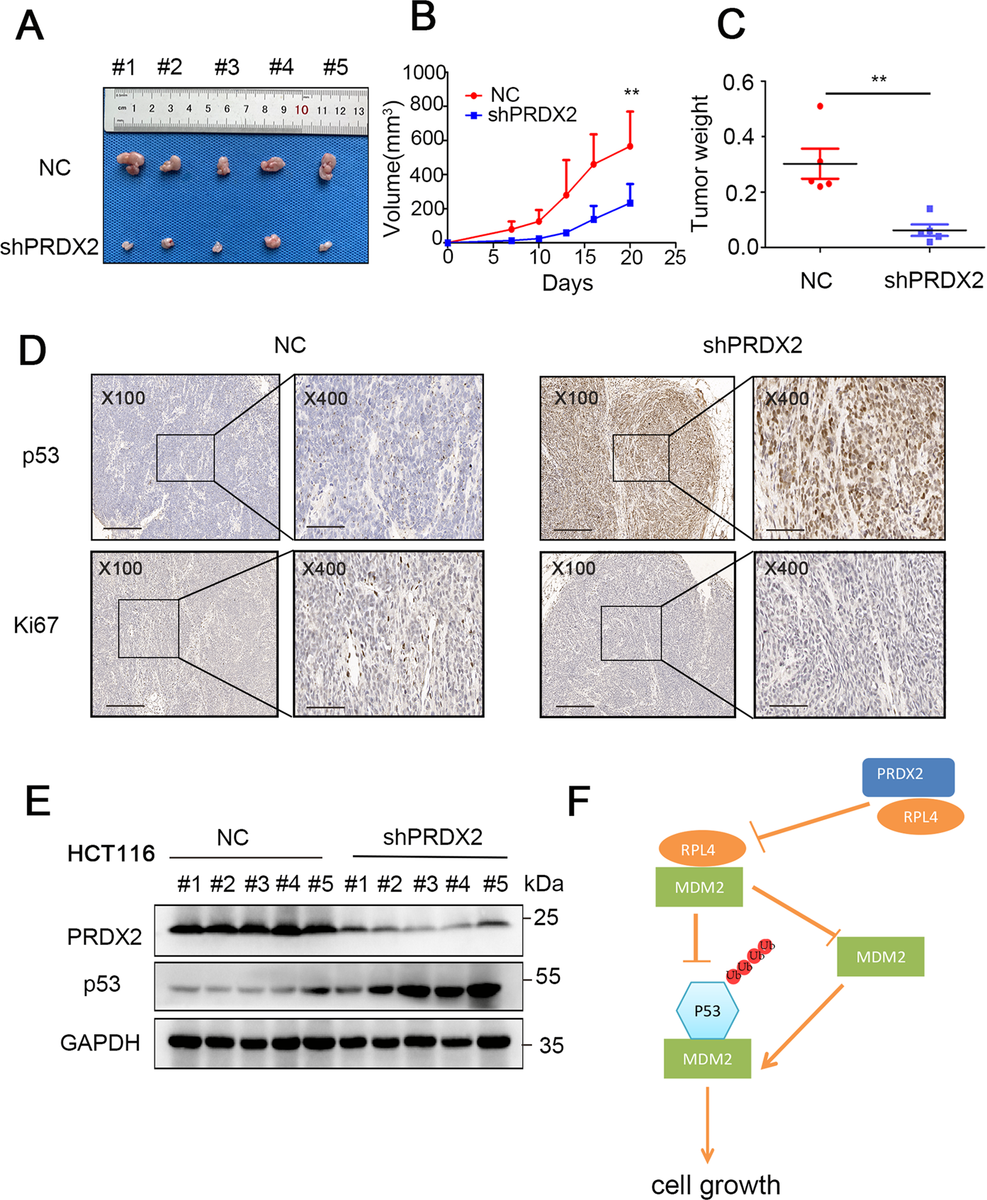 Fig. 7: PRDX2 knockdown retards tumor growth by inducing p53 upregulation.