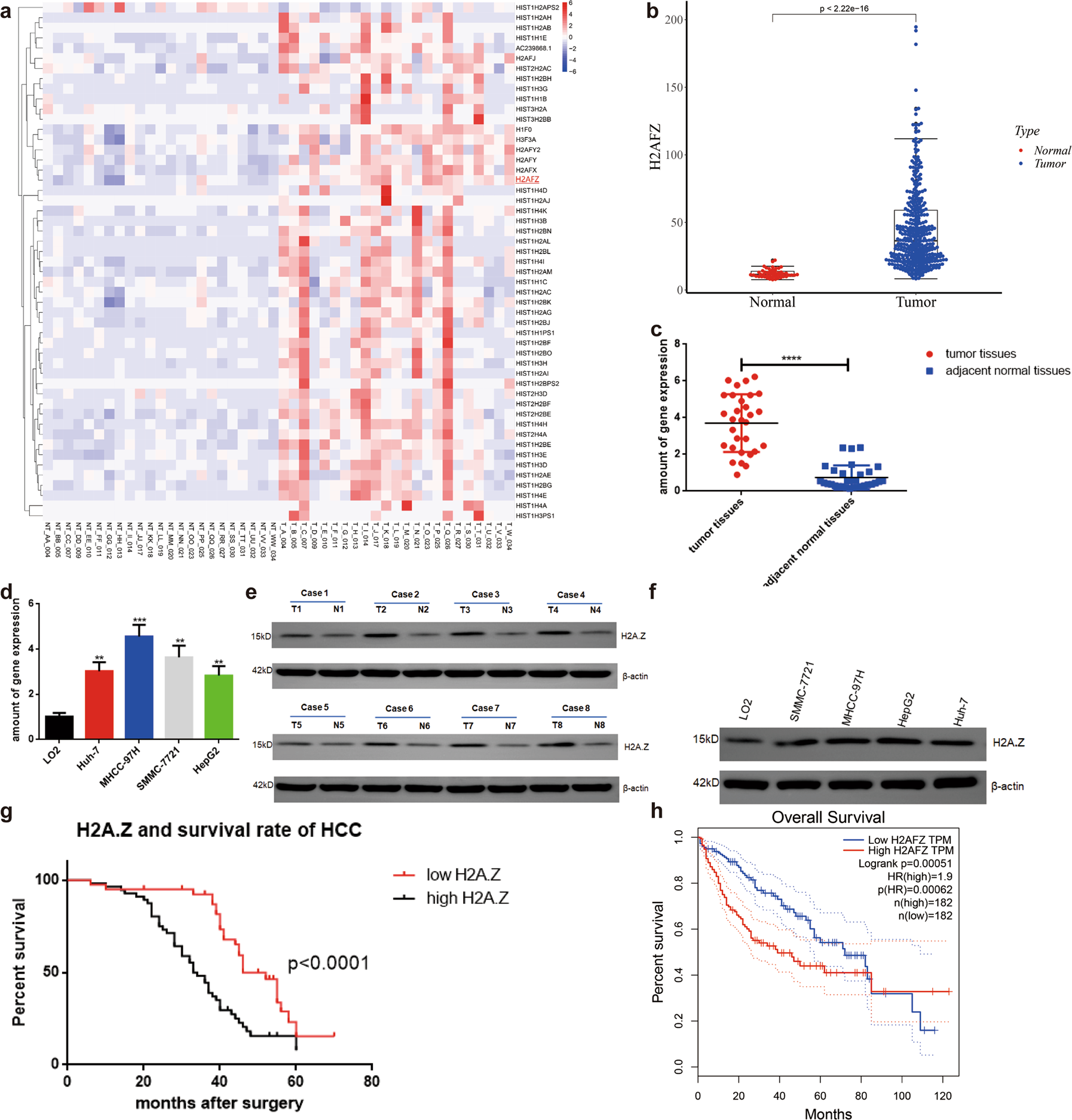 H2A.Z acetylation by lincZNF337-AS1 via KAT5 implicated in the  transcriptional misregulation in cancer signaling pathway in hepatocellular  carcinoma | Cell Death & Disease