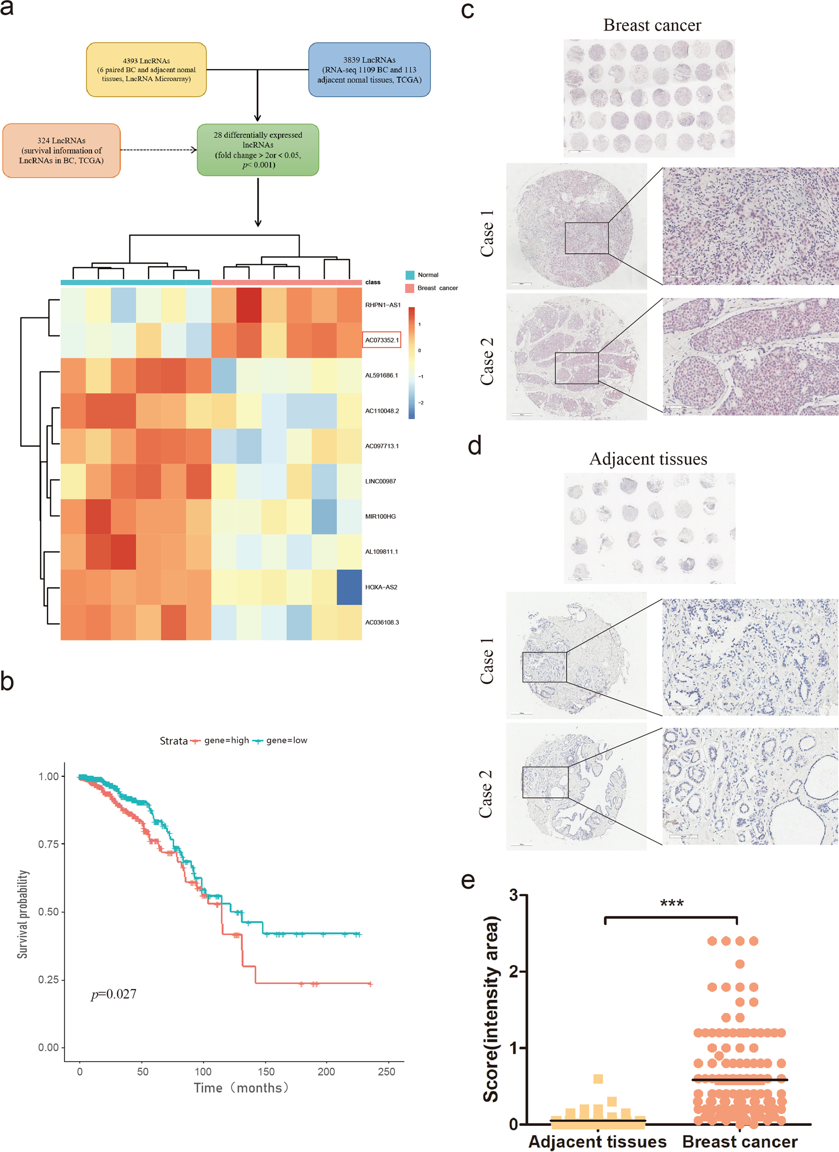 A novel long non-coding RNA AC073352.1 promotes metastasis and angiogenesis  via interacting with YBX1 in breast cancer | Cell Death & Disease