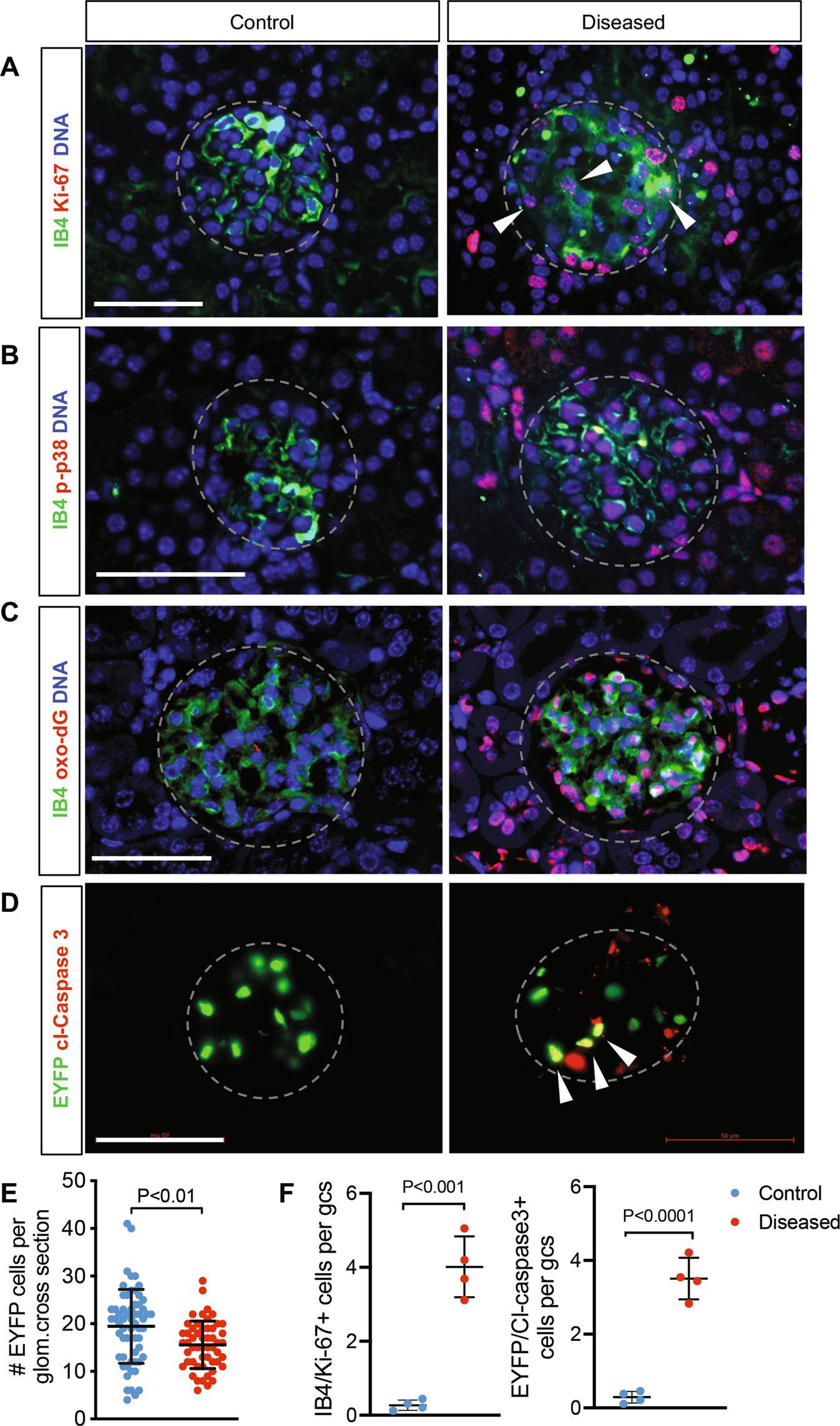 Fig. 6: Podocyte loss results in net GEC loss.