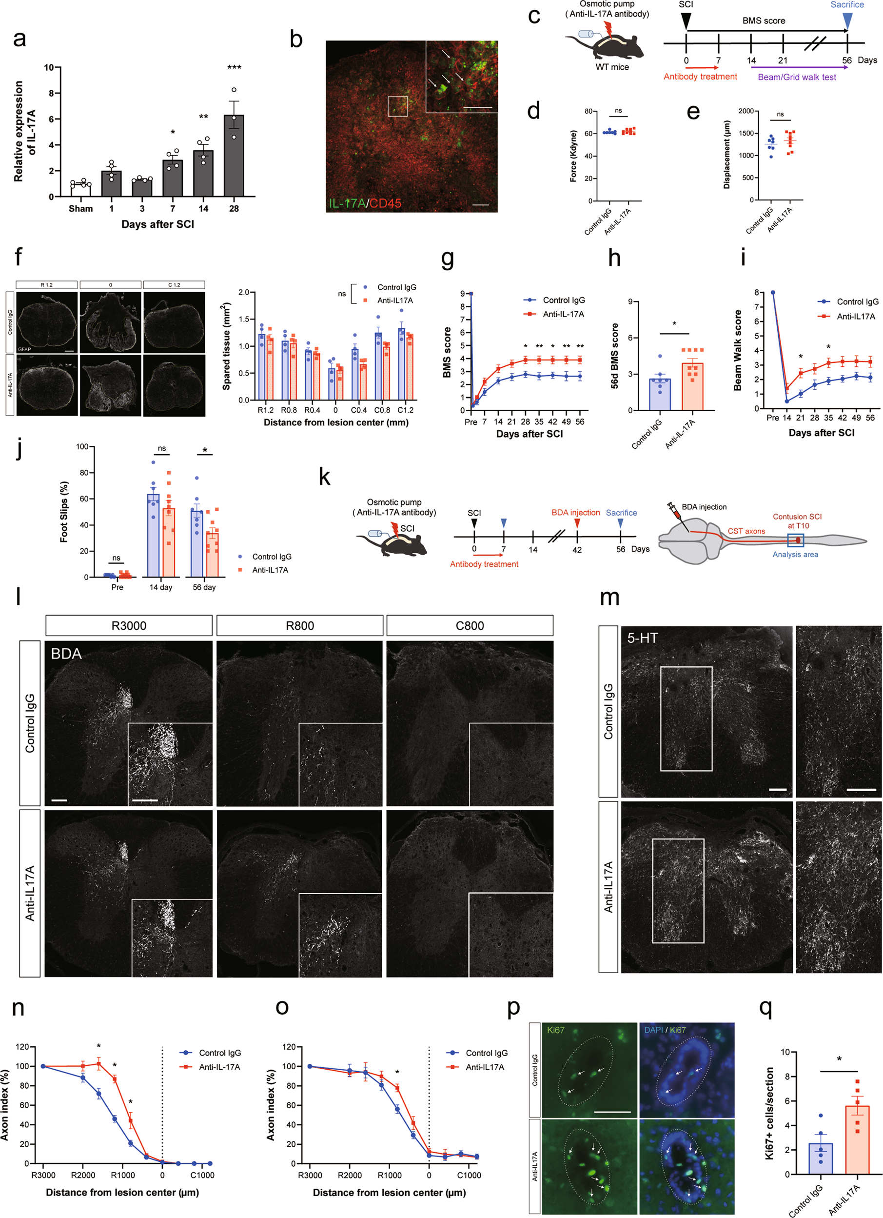 Interleukin-17A regulates ependymal cell proliferation and functional  recovery after spinal cord injury in mice | Cell Death & Disease