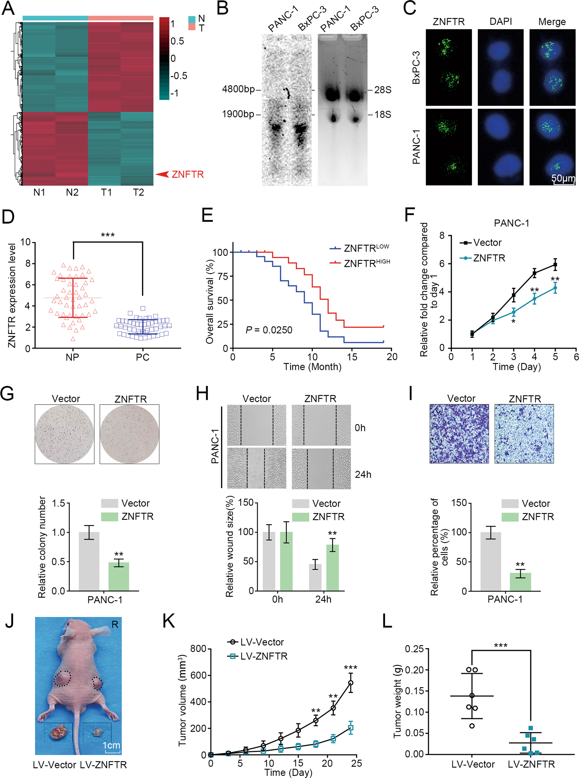 Lncrna Znftr Functions As An Inhibitor In Pancreatic Cancer By Modulating Atf3 Znf24 Vegfa Pathway Cell Death Disease Lncrna Znftr Functions As An Inhibitor In Pancreatic Cancer By Modulating Atf3 Znf24 Vegfa Pathway Cell Death Disease