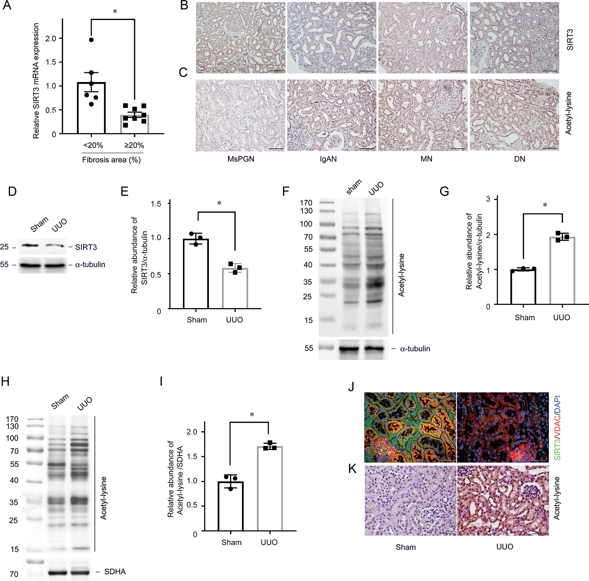 Sirtuin 3 regulates mitochondrial protein acetylation and metabolism in  tubular epithelial cells during renal fibrosis | Cell Death & Disease