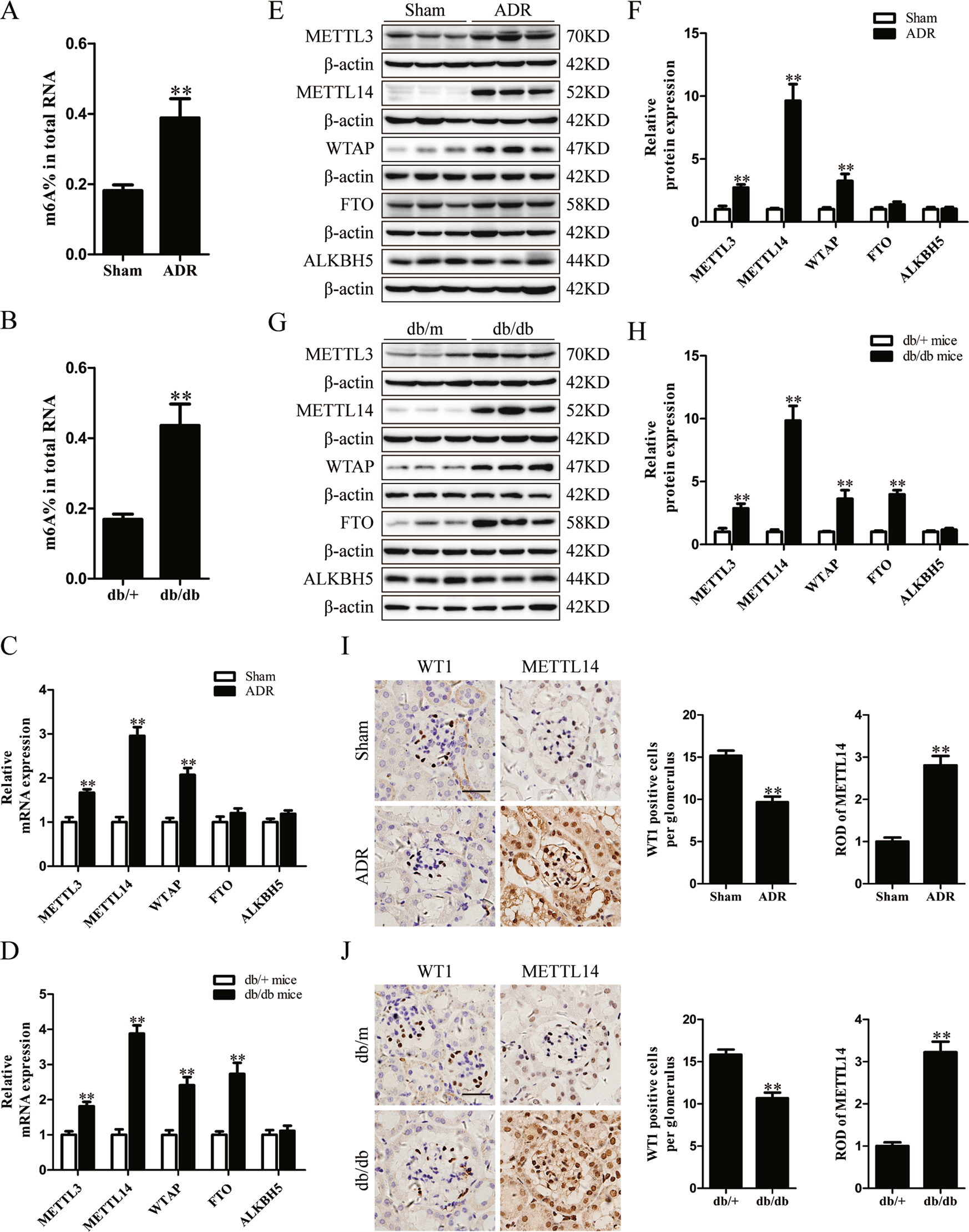 mettl14 aggravates podocyte injury and glomerulopathy progression through n6 methyladenosine dependent downregulating of sirt1 cell death disease mettl14 aggravates podocyte injury and glomerulopathy progression through n6 methyladenosine dependent downregulating of sirt1 cell death disease