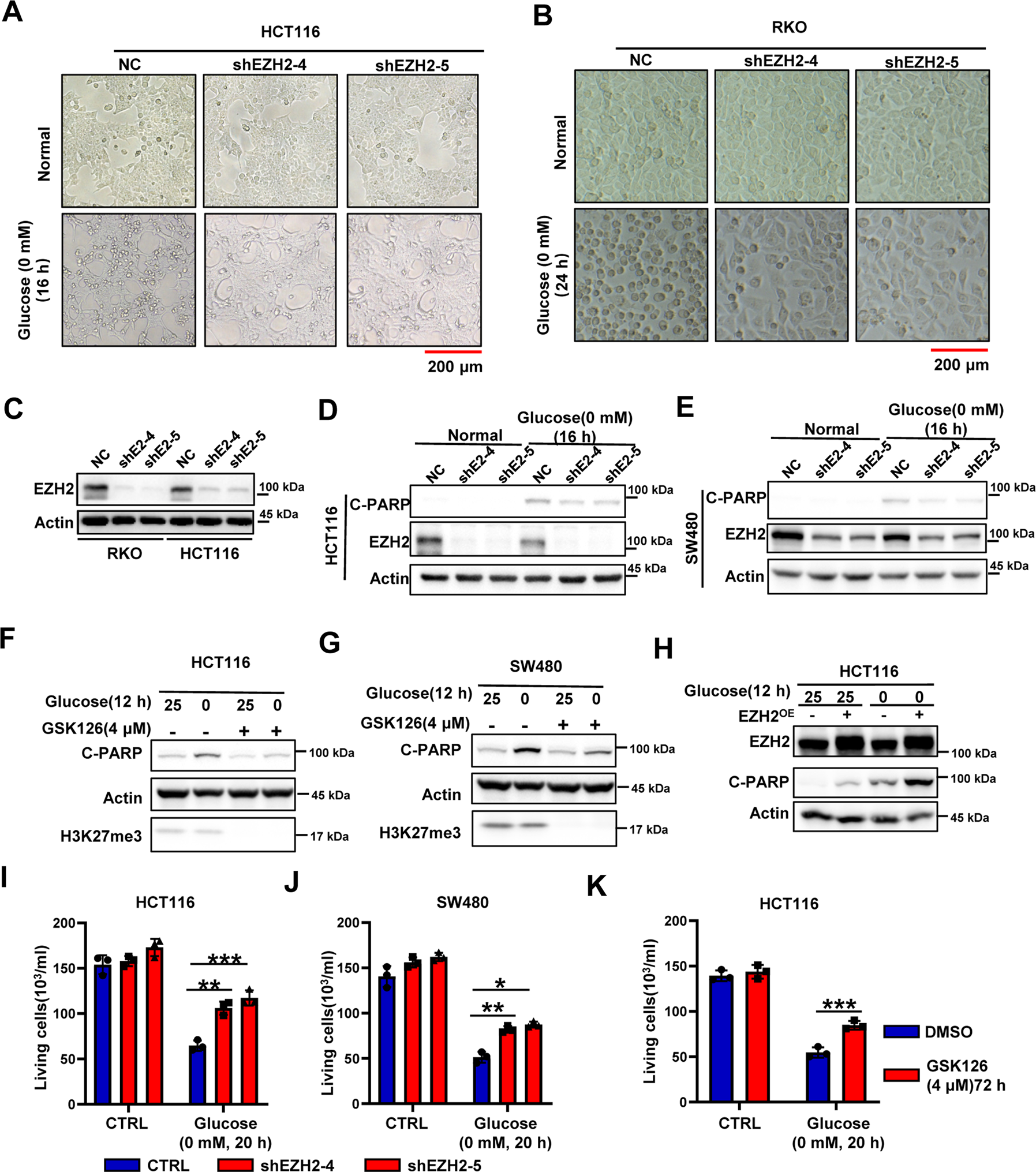 Fig. 2: Absence of EZH2 in glucose-sensitive CRCs enhanced the tolerance to glucose-deprivation-induced cell death.