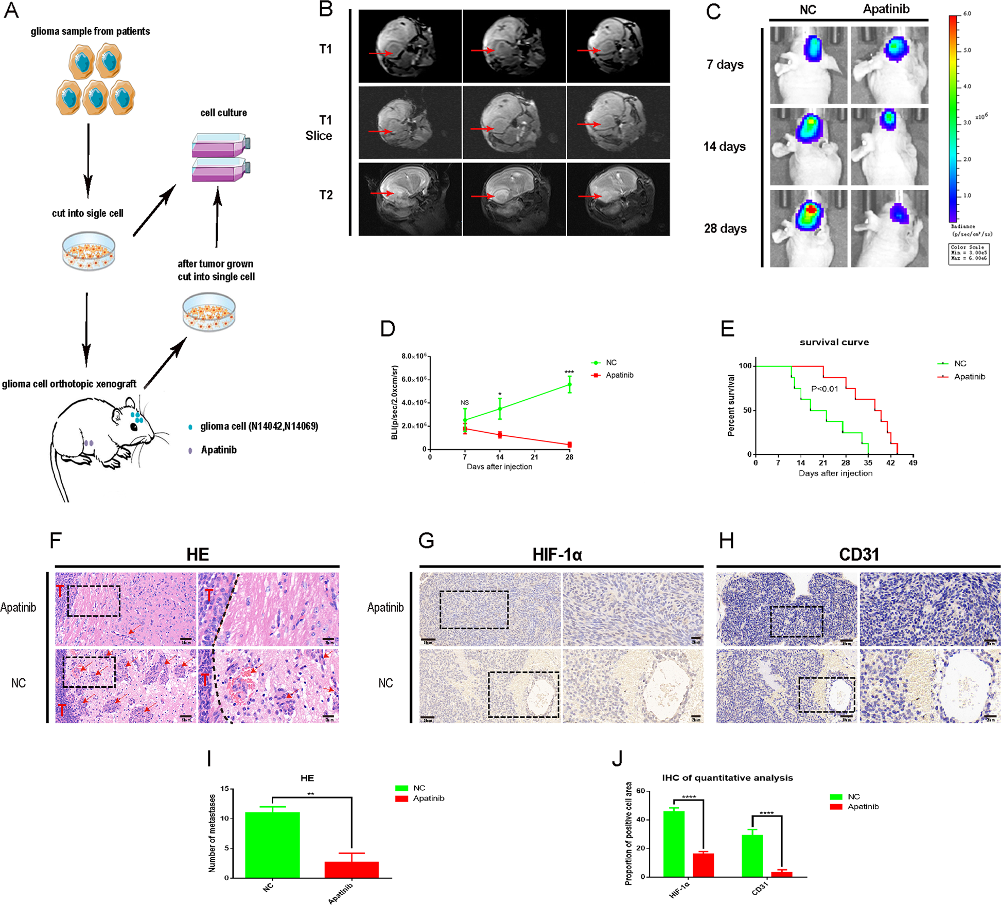Apatinib inhibits glioma cell malignancy in patient-derived orthotopic  xenograft mouse model by targeting thrombospondin 1/myosin heavy chain 9  axis | Cell Death & Disease