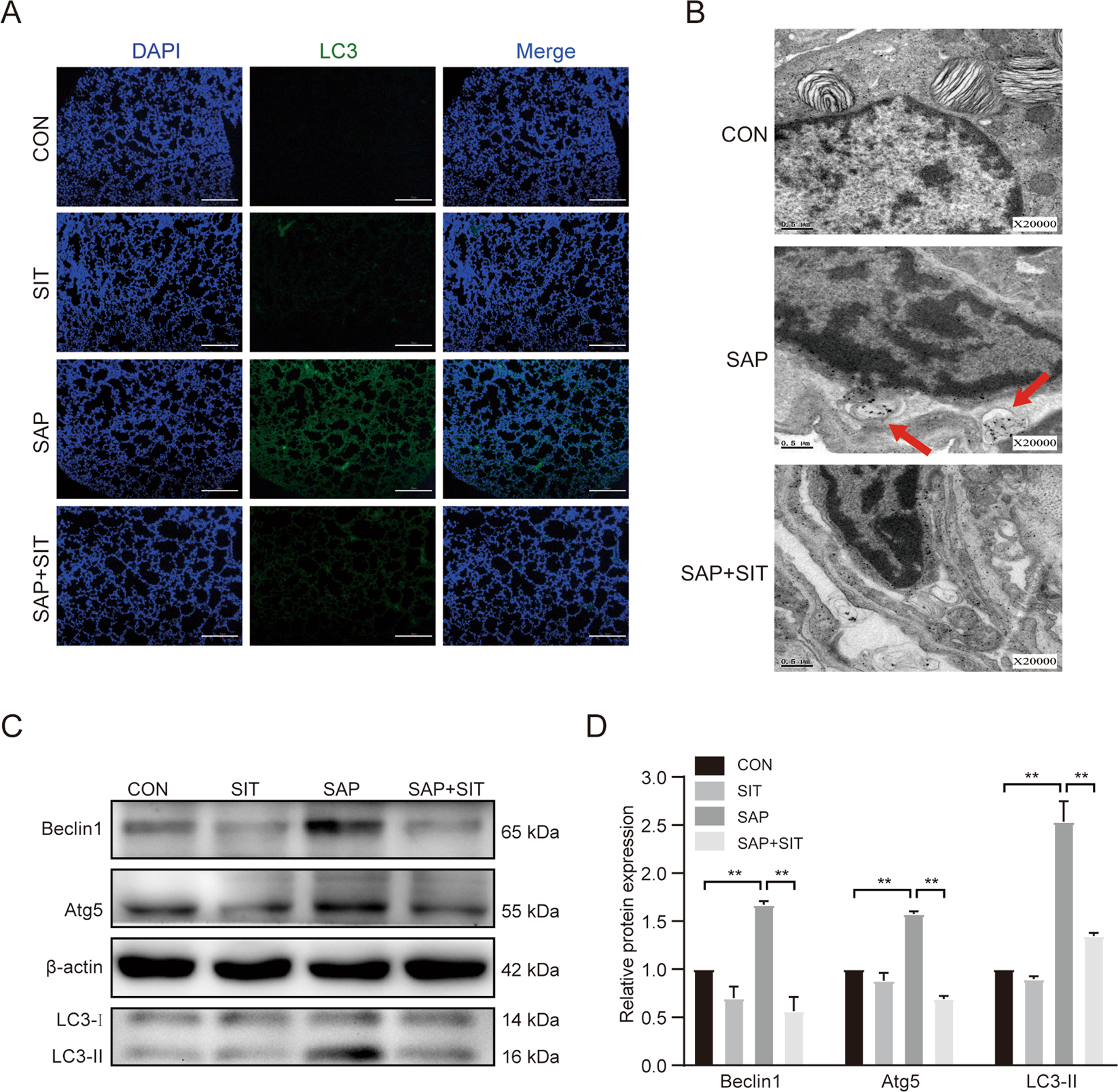Fig. 2: Sitagliptin downregulated autophagy level in SAP-ALI.