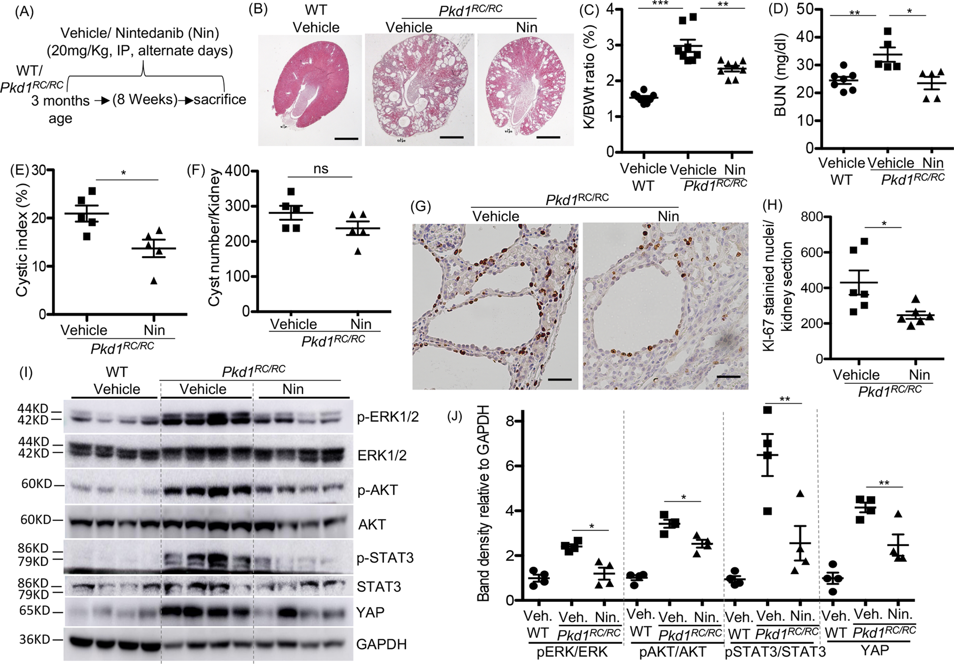 Fig. 2: Nintedanib (Nin) treatment reduced renal cyst growth and cell proliferation in Pkd1RC/RC mice.